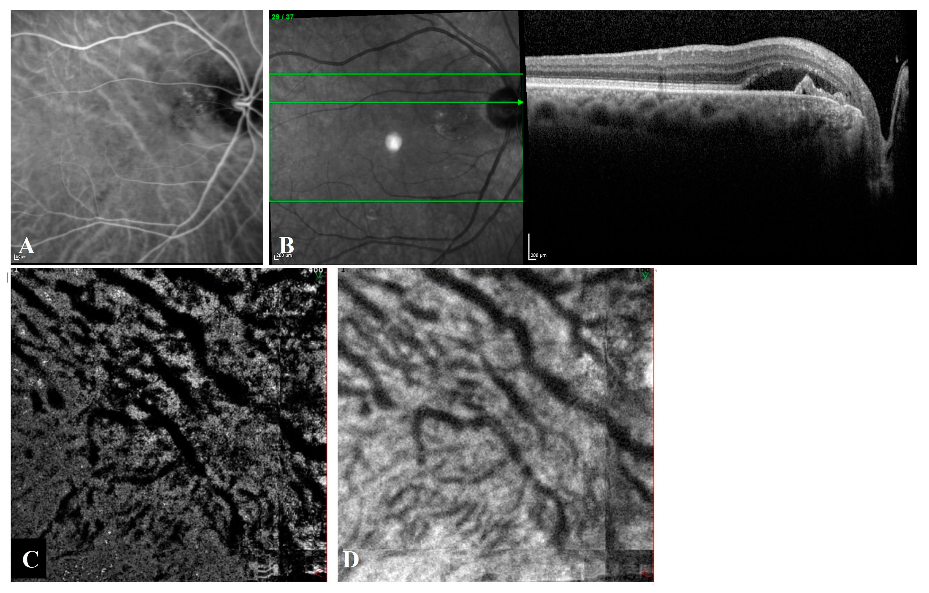 Diagnostics 13 00138 g003