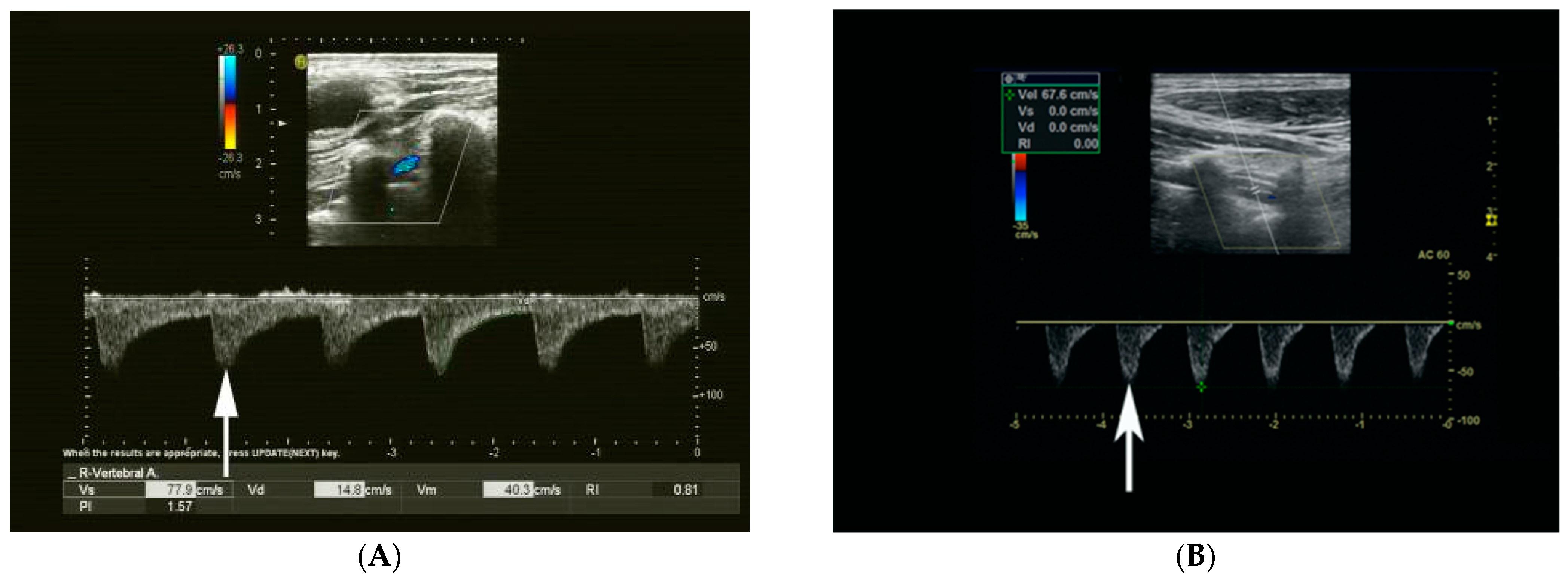 Diagnostics 13 00146 g002