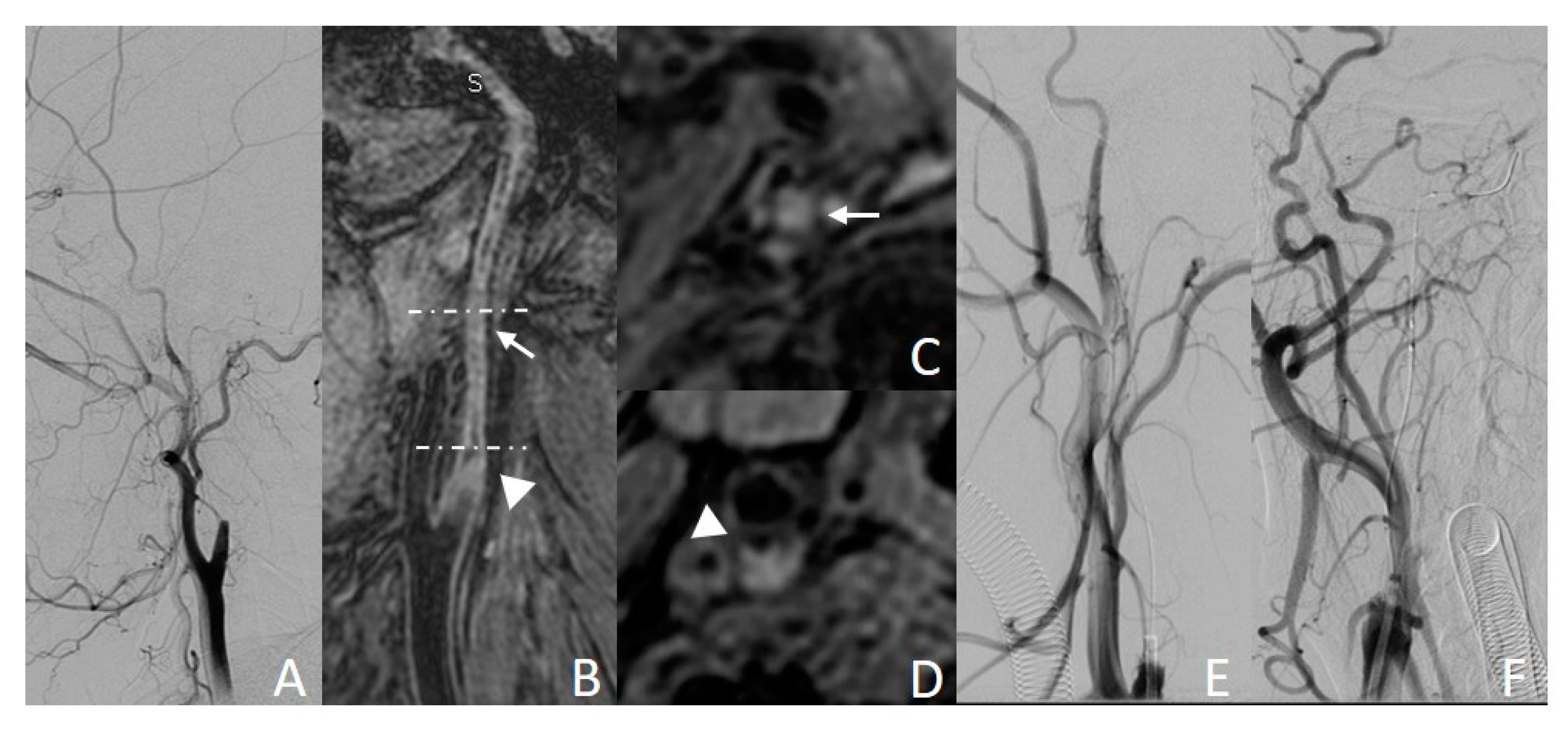 Diagnostics 13 00147 g004 Diagnostics 13 00147 g004