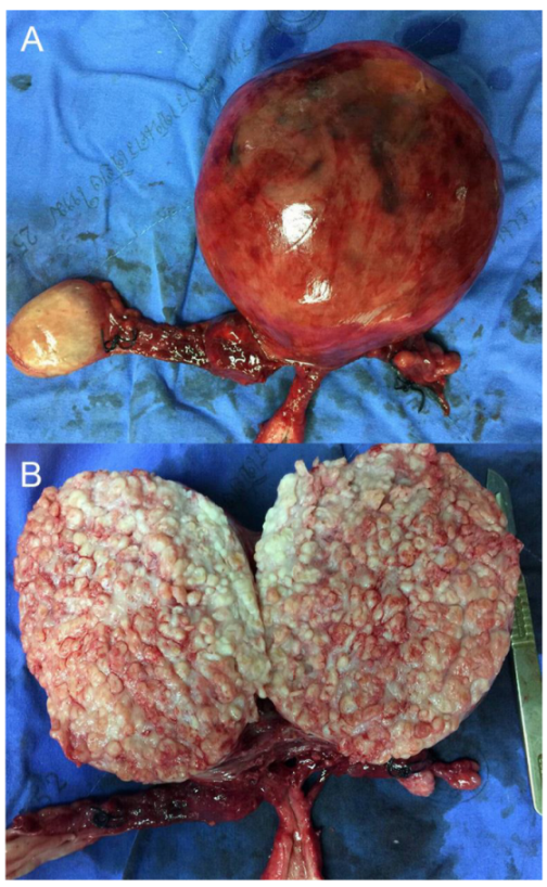 Diagnostics 13 00154 g003
