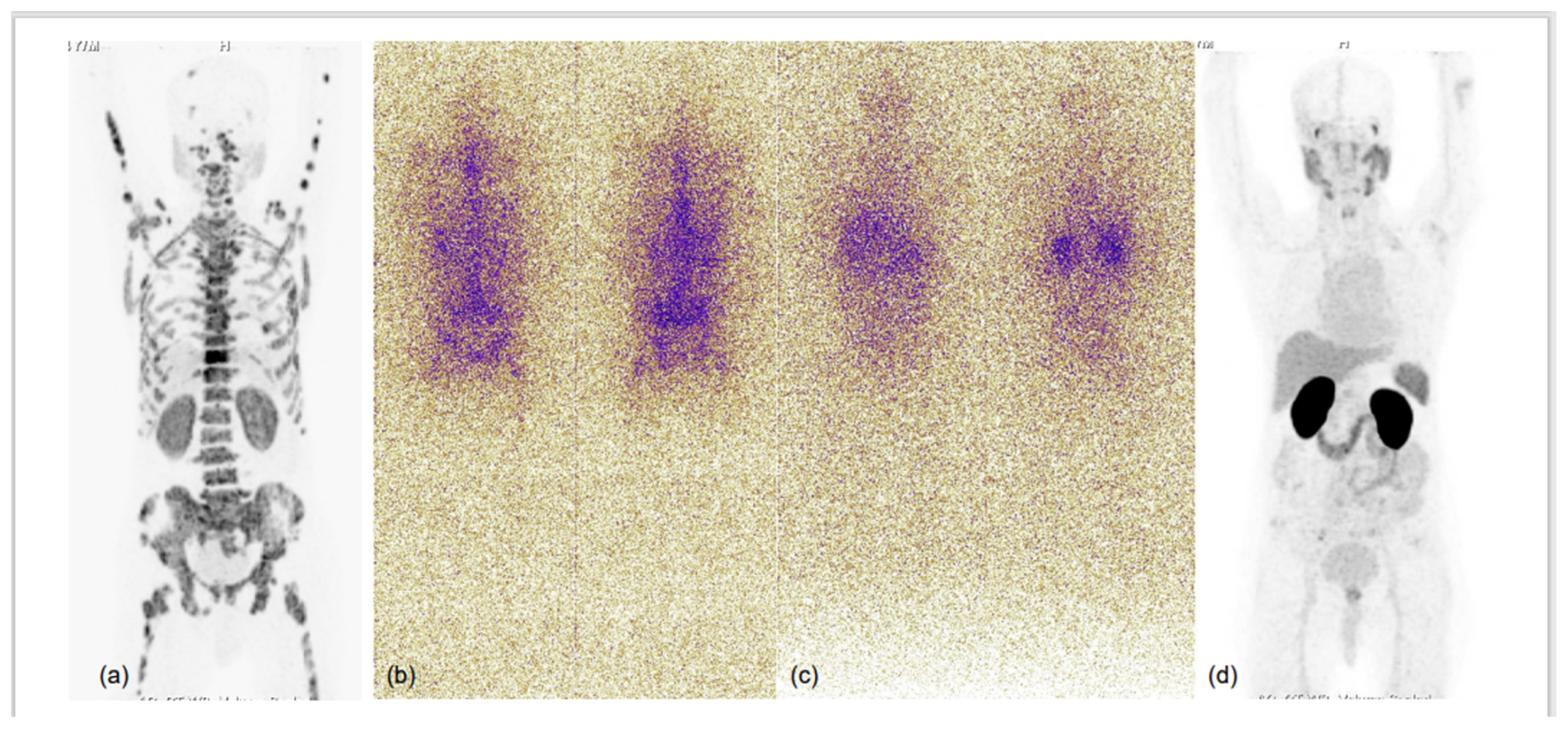 Diagnostics 13 00158 g004