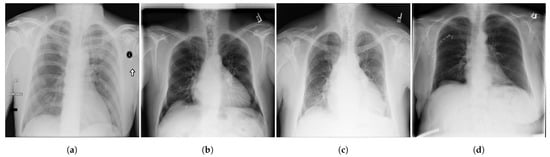 Diagnostics 13 00159 g002