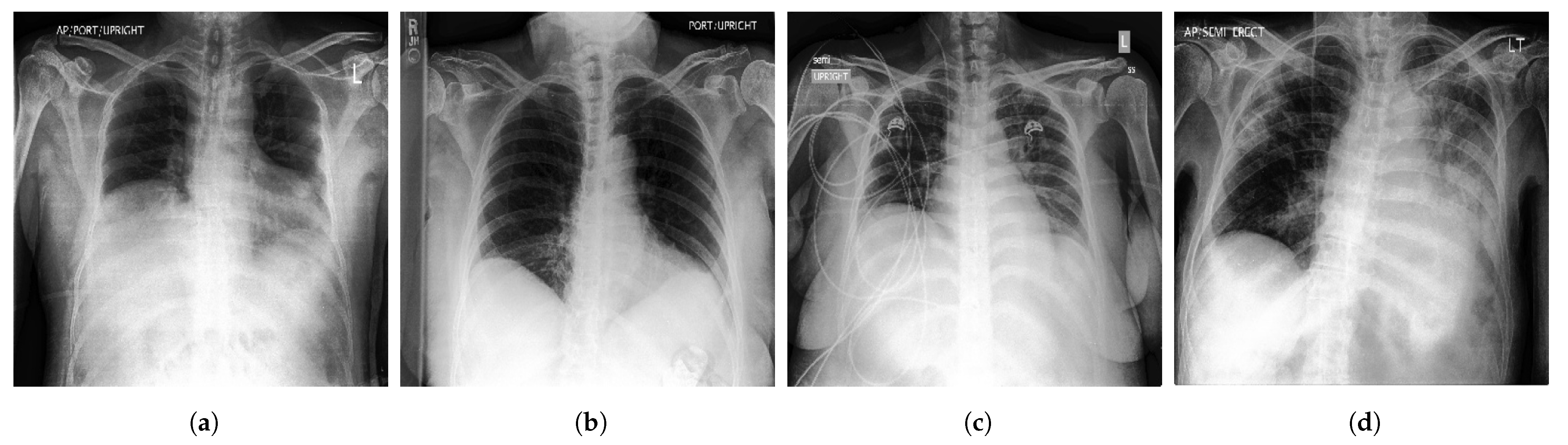 Diagnostics 13 00159 g003
