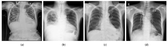 Diagnostics 13 00159 g004