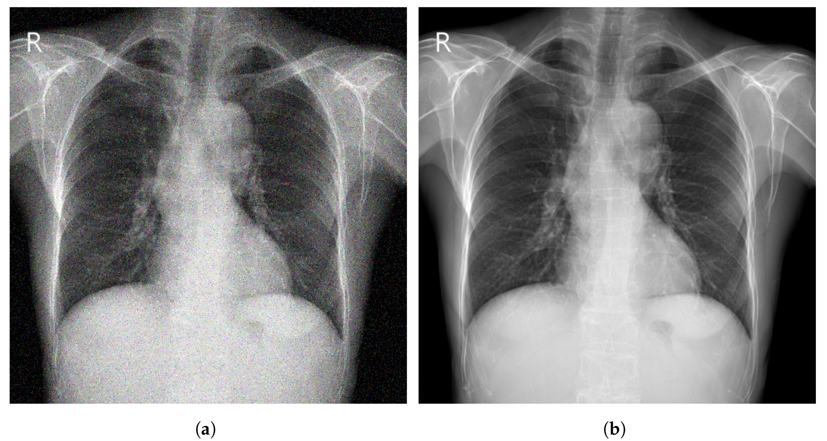 Diagnostics 13 00159 g005