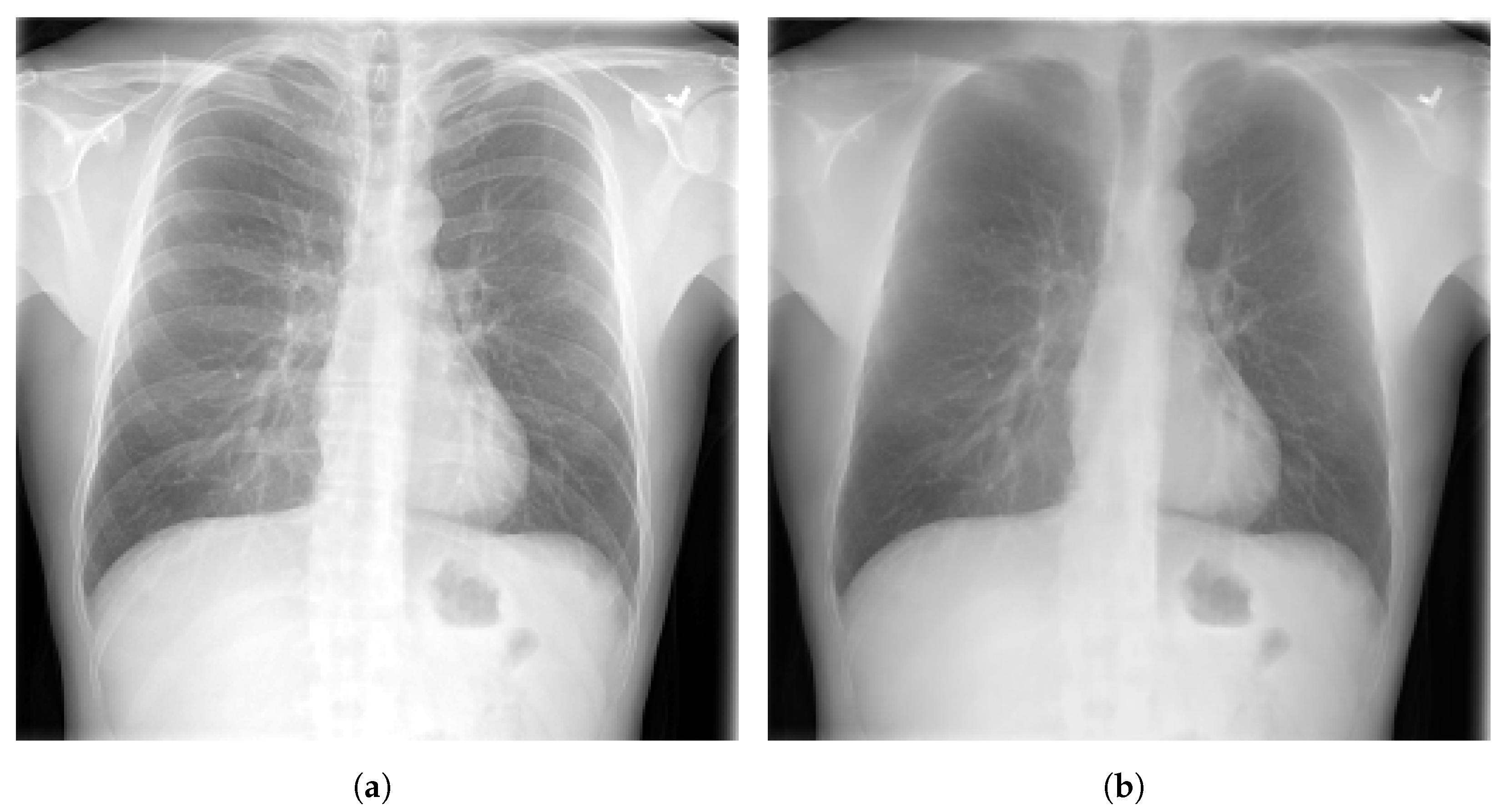Diagnostics 13 00159 g007