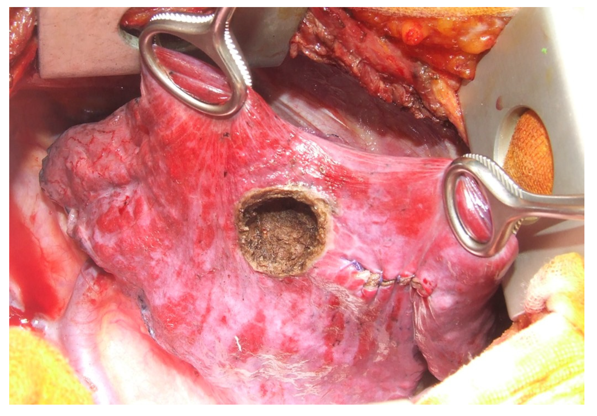 Diagnostics 13 00165 g007