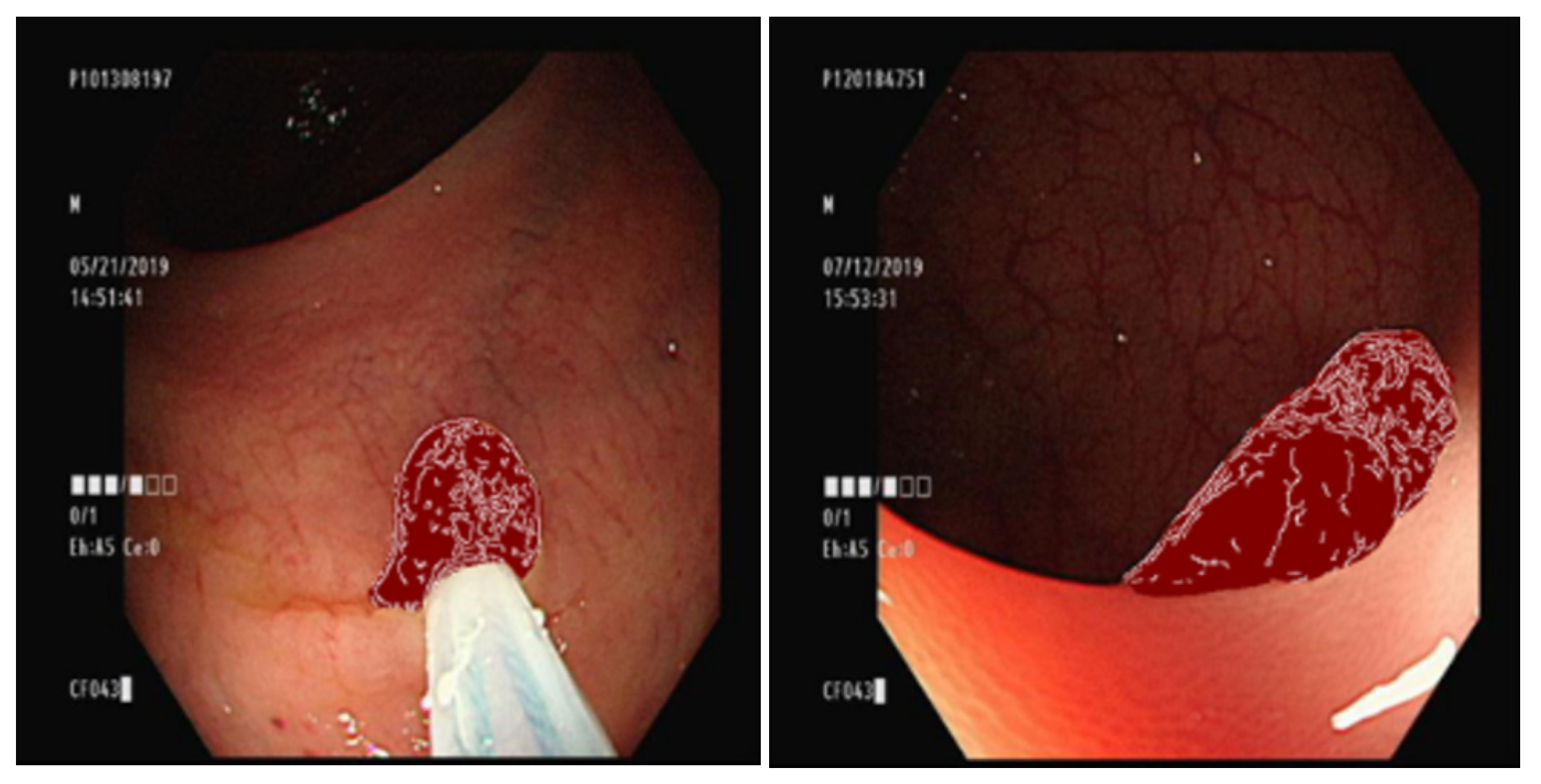 Diagnostics 13 00170 g004