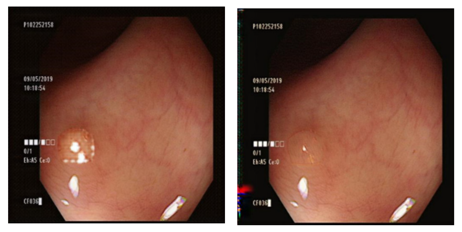 Diagnostics 13 00170 g012