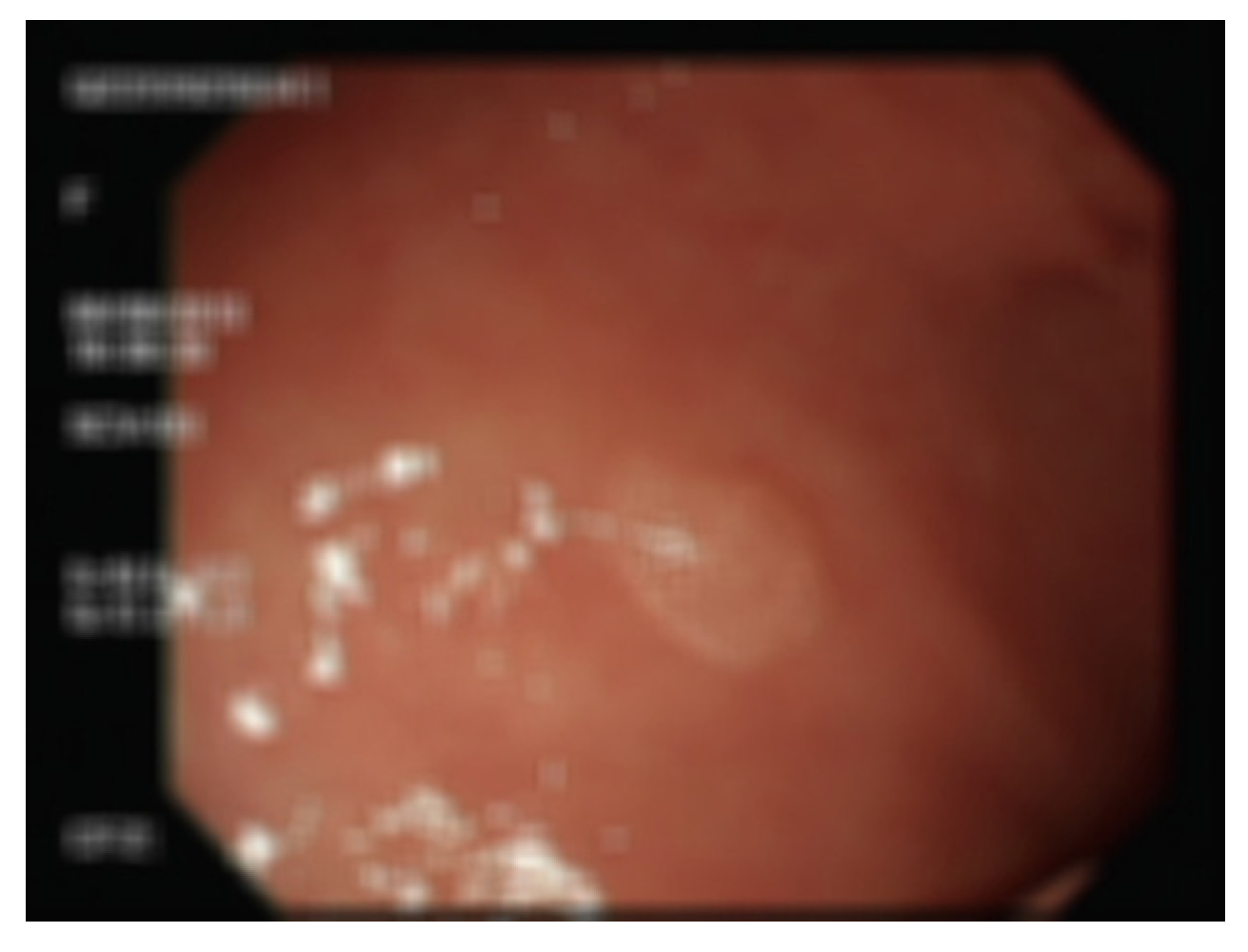 Diagnostics 13 00170 g013