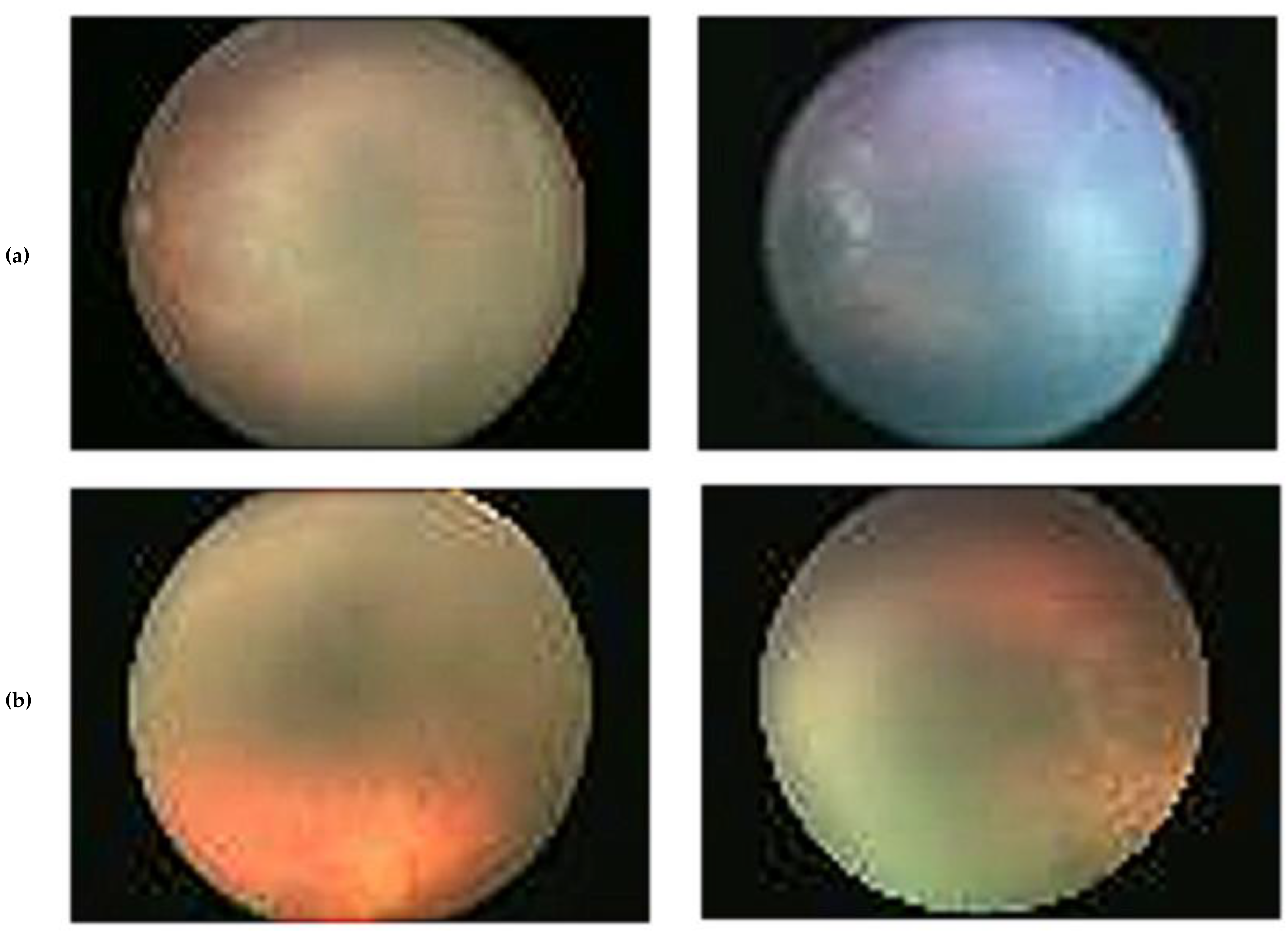 Diagnostics 13 00171 g001 Diagnostics 13 00171 g001