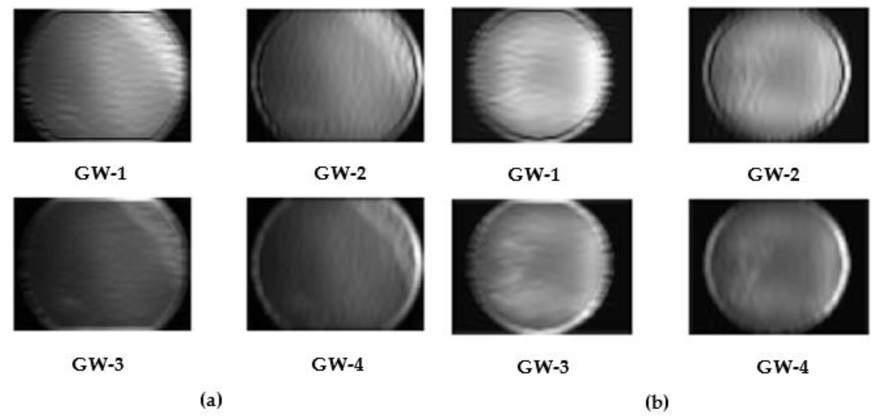 Diagnostics 13 00171 g003 Diagnostics 13 00171 g003