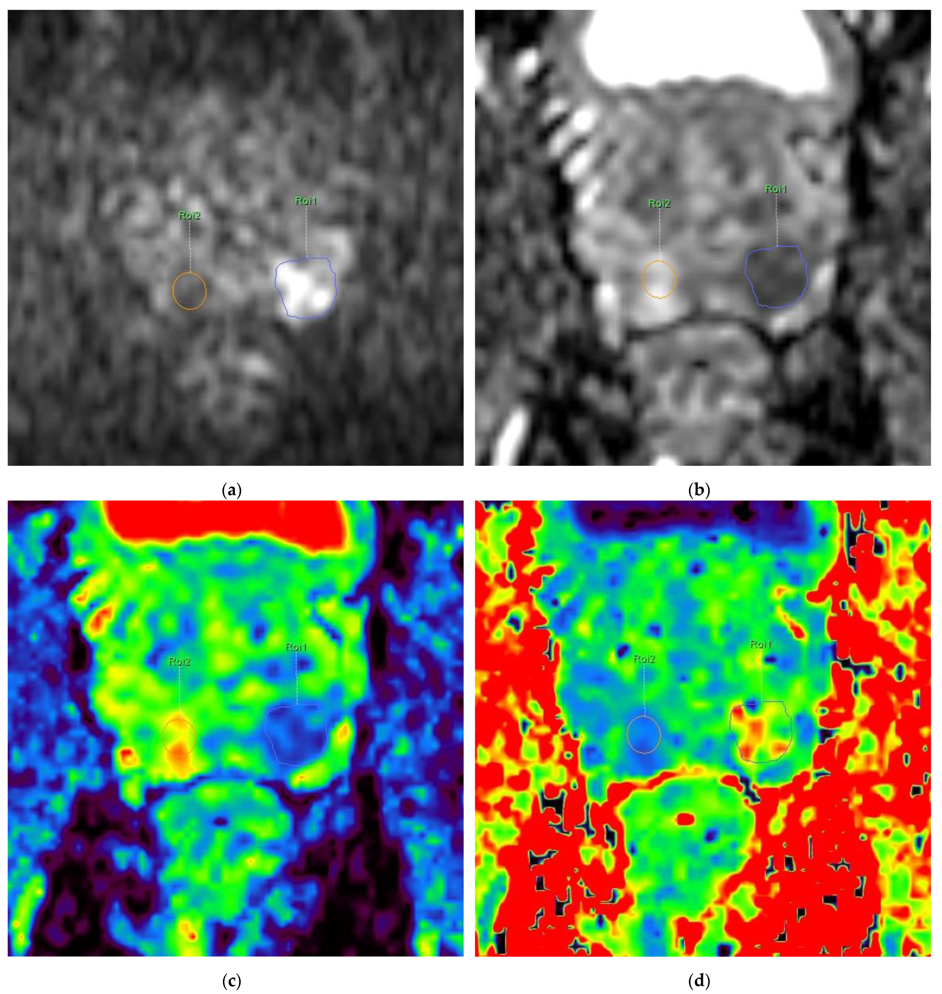 Diagnostics 13 00173 g001a Diagnostics 13 00173 g001a