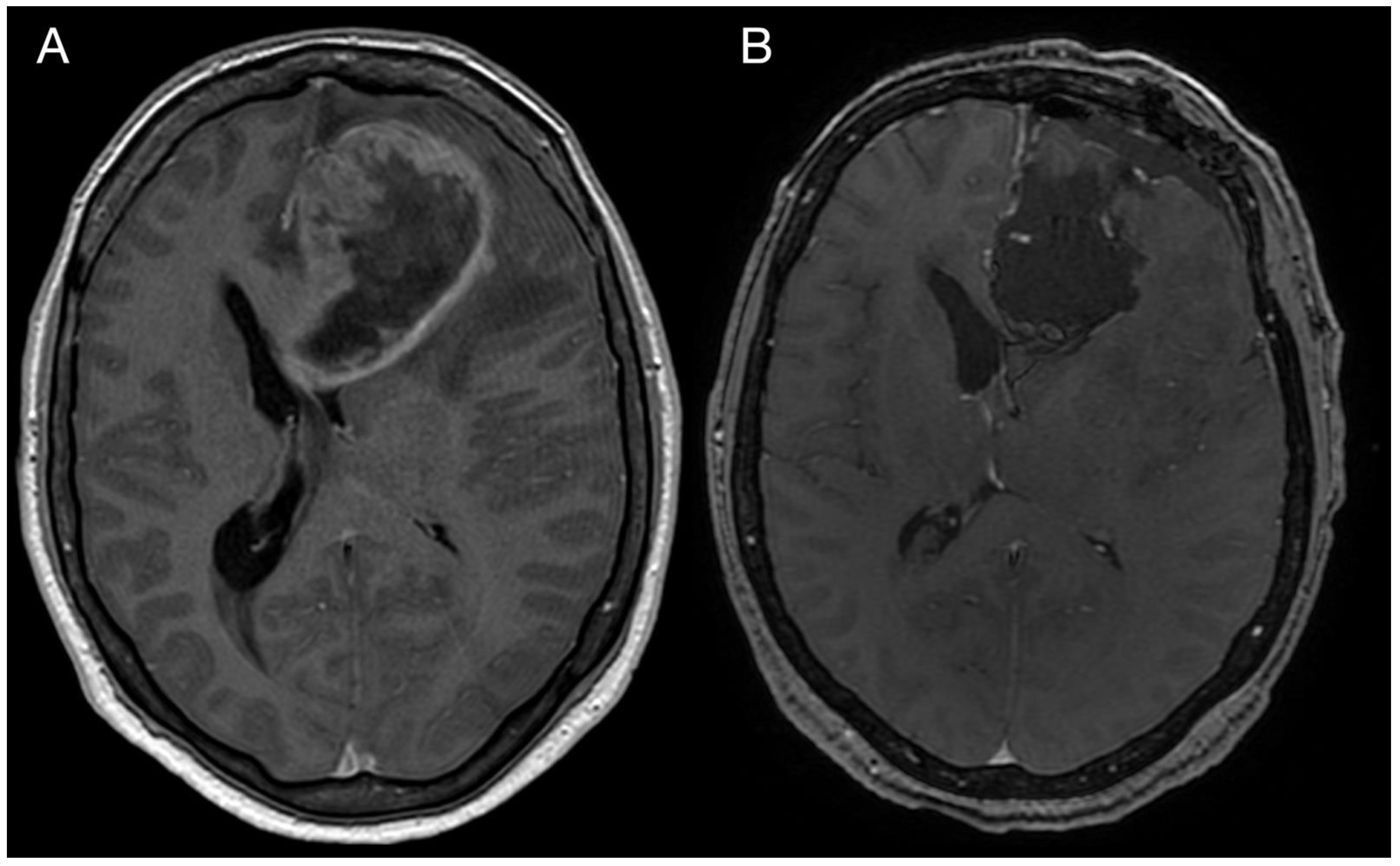 Diagnostics 13 00181 g001 Diagnostics 13 00181 g001