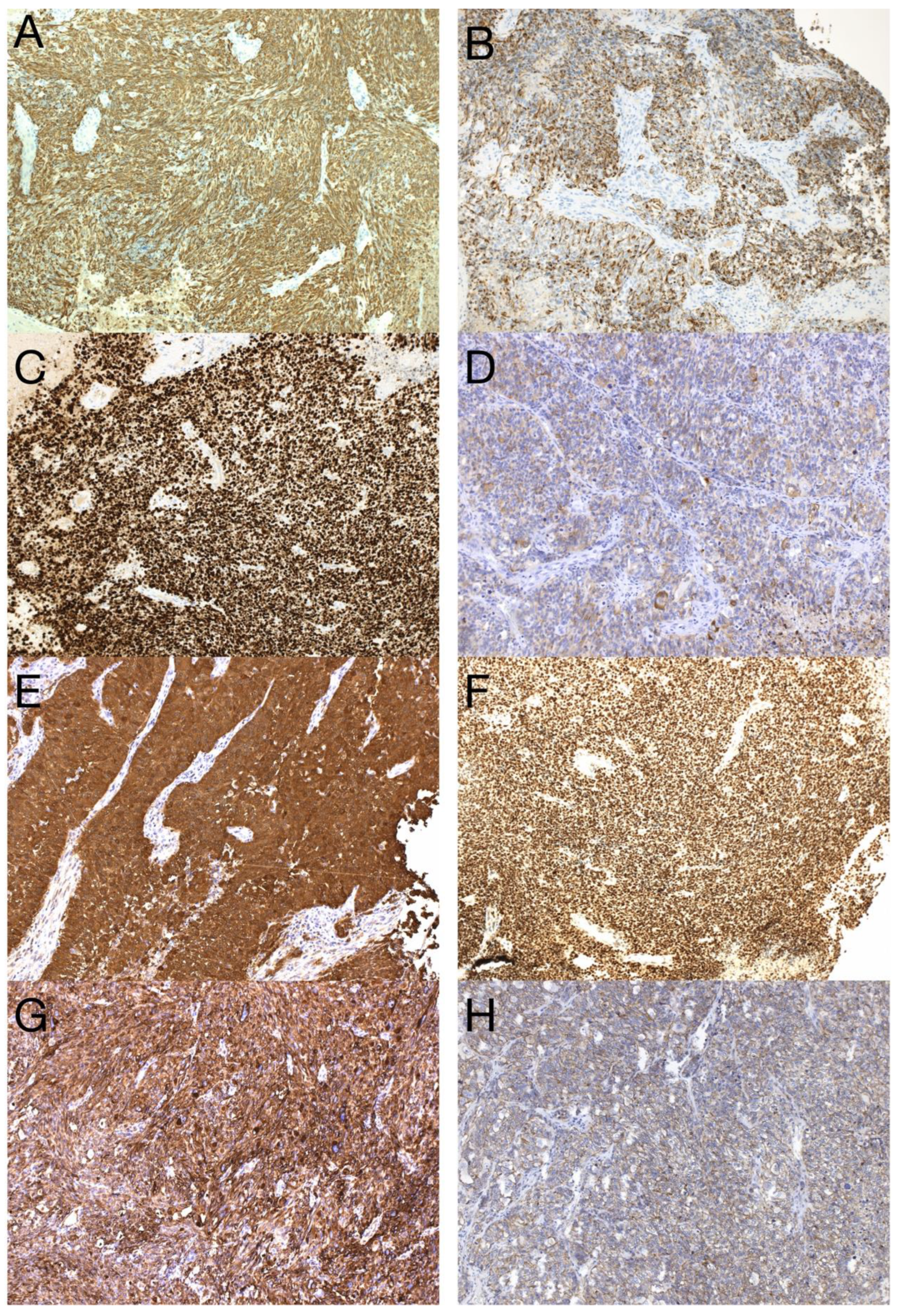 Diagnostics 13 00181 g003 Diagnostics 13 00181 g003