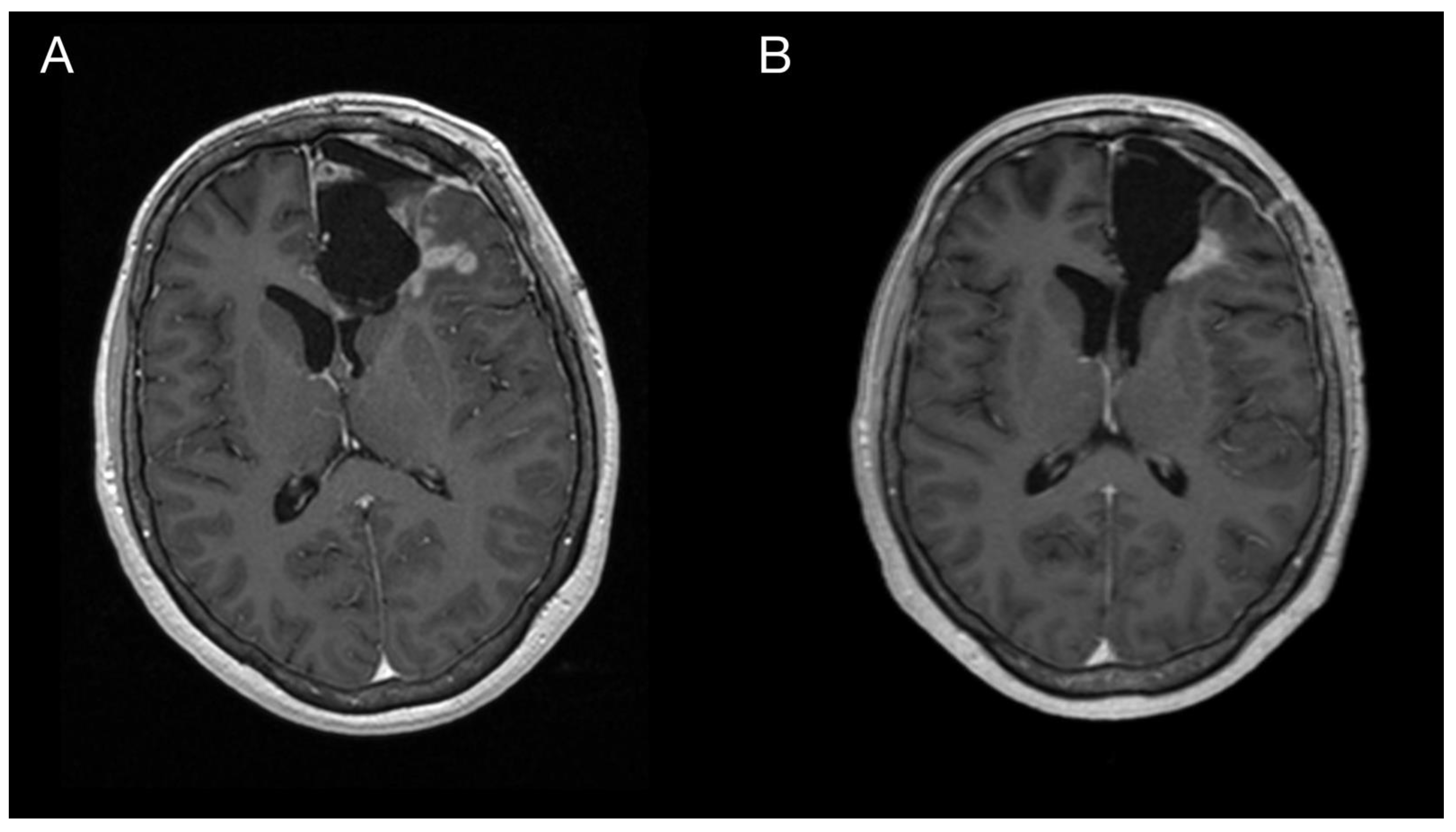 Diagnostics 13 00181 g004 Diagnostics 13 00181 g004