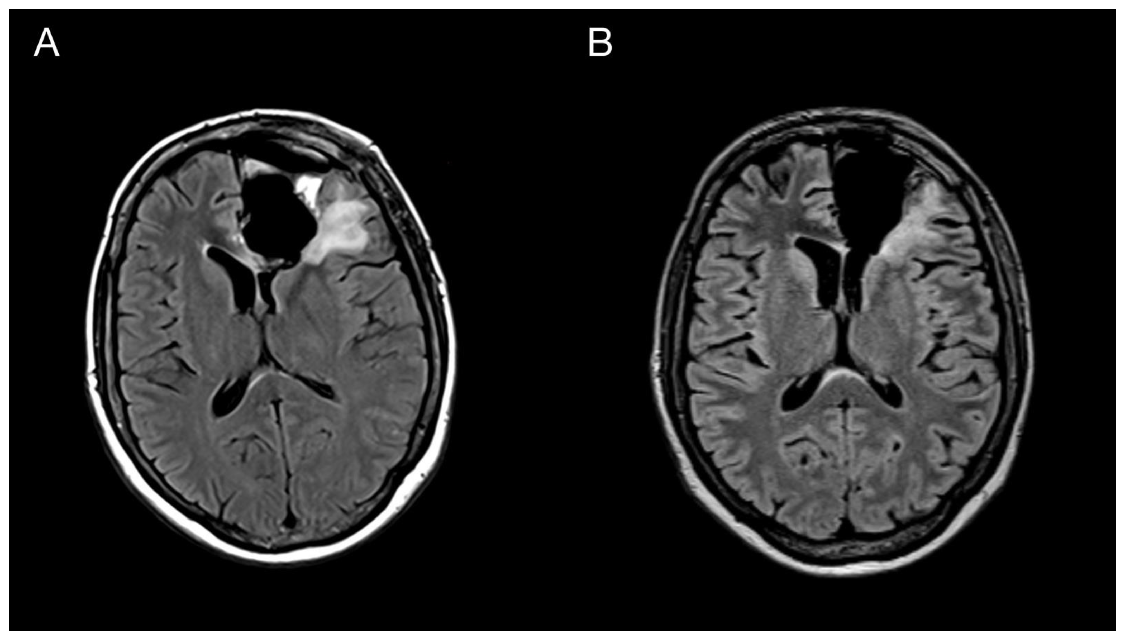 Diagnostics 13 00181 g005 Diagnostics 13 00181 g005