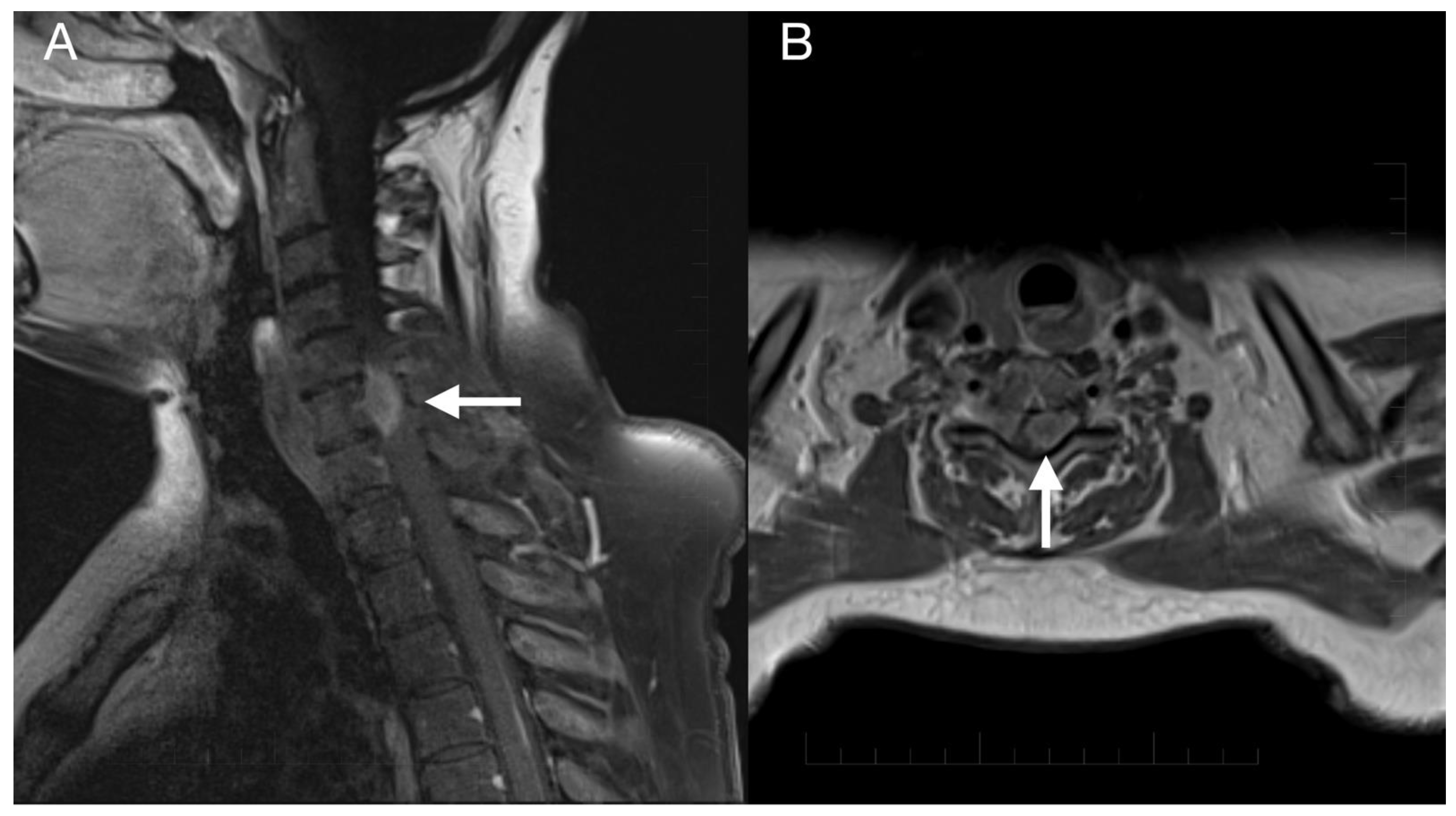 Diagnostics 13 00181 g006 Diagnostics 13 00181 g006