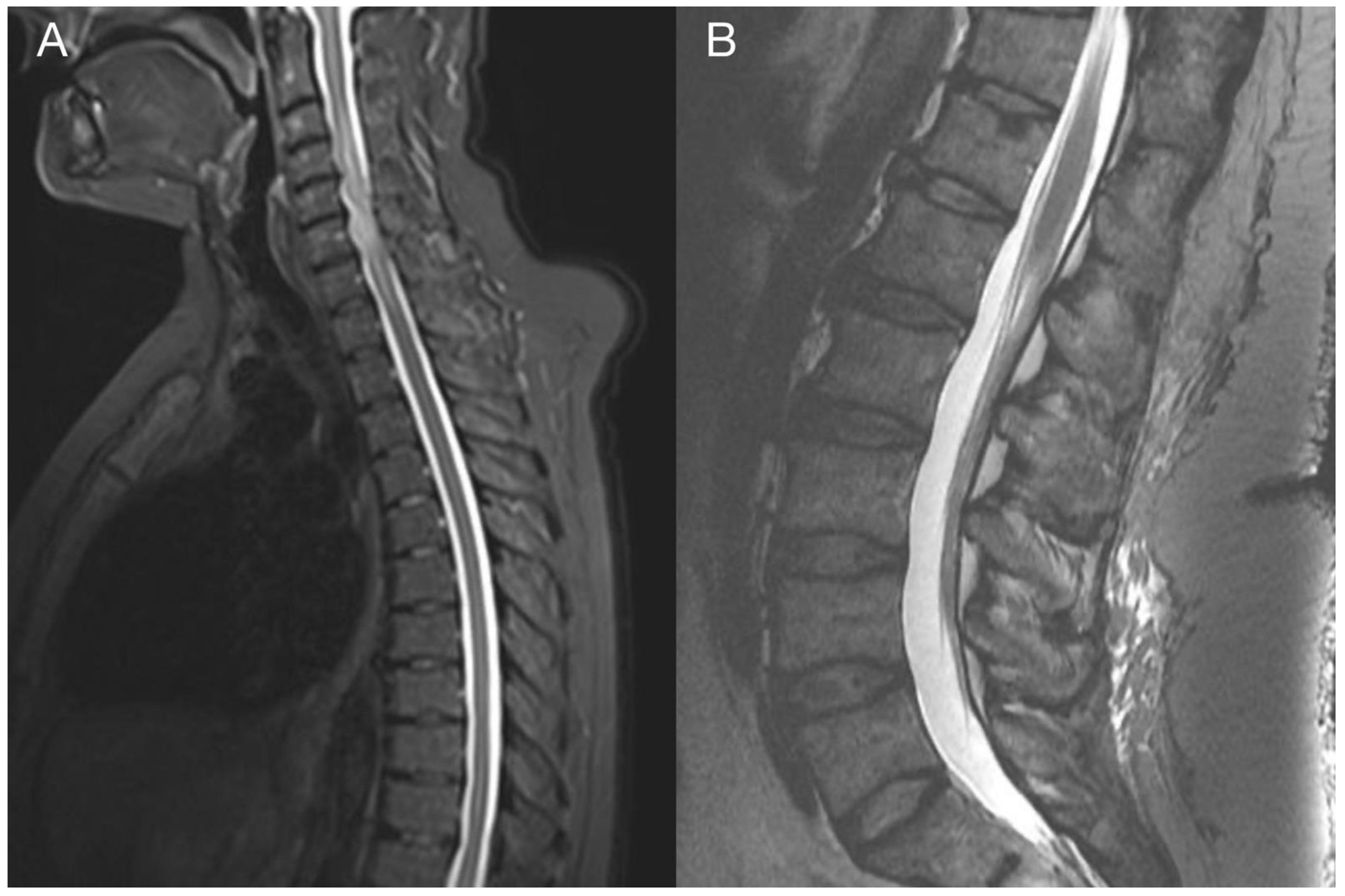 Diagnostics 13 00181 g007 Diagnostics 13 00181 g007
