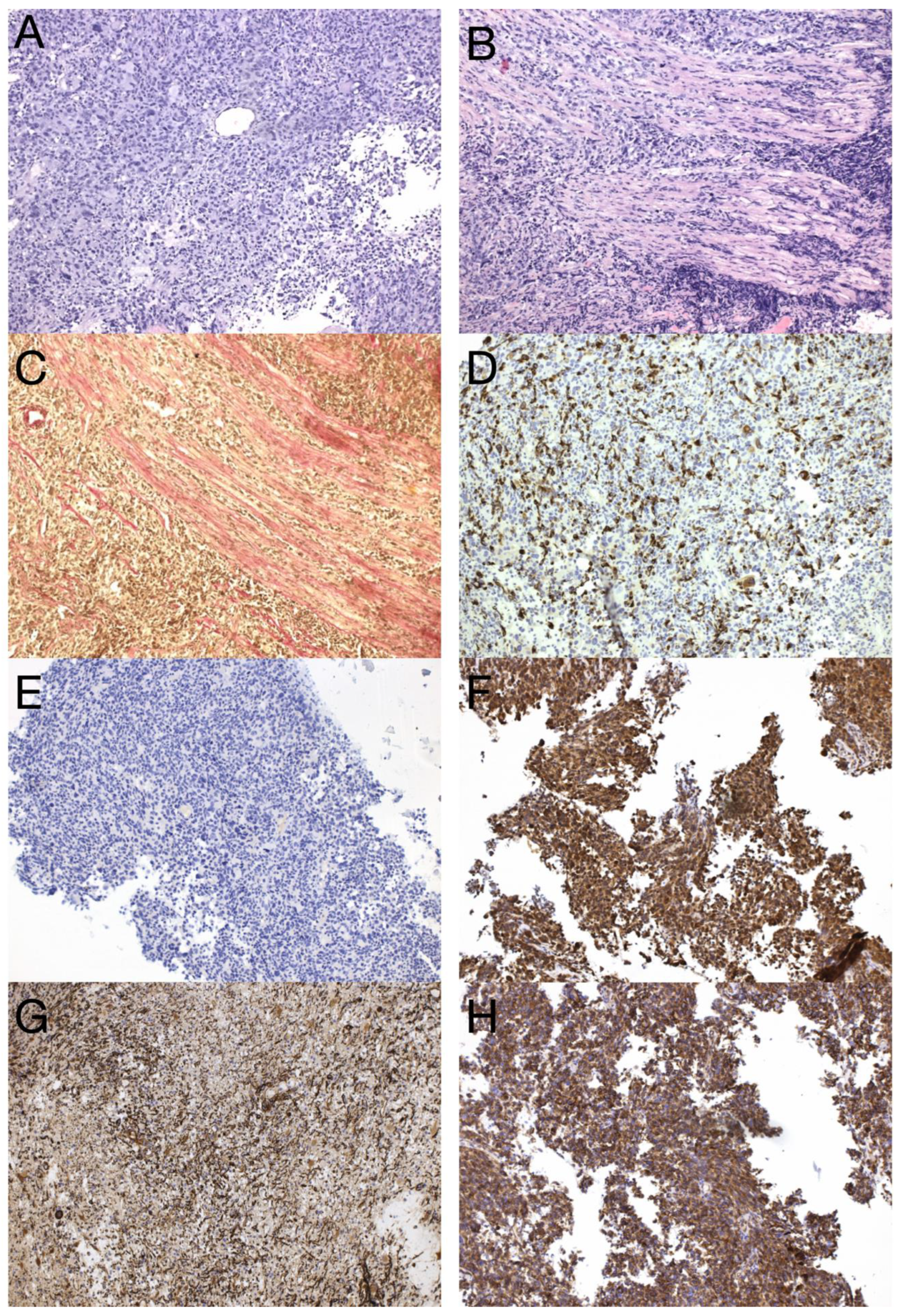 Diagnostics 13 00181 g008 Diagnostics 13 00181 g008