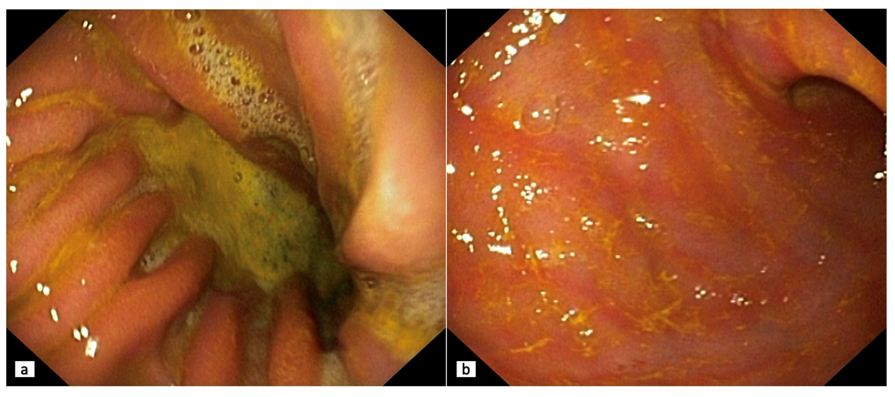Diagnostics 13 00186 g002