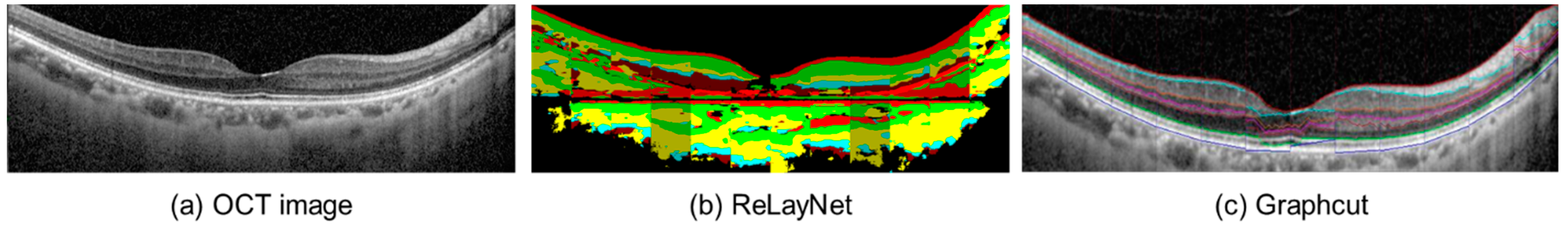 Diagnostics 13 00189 g004