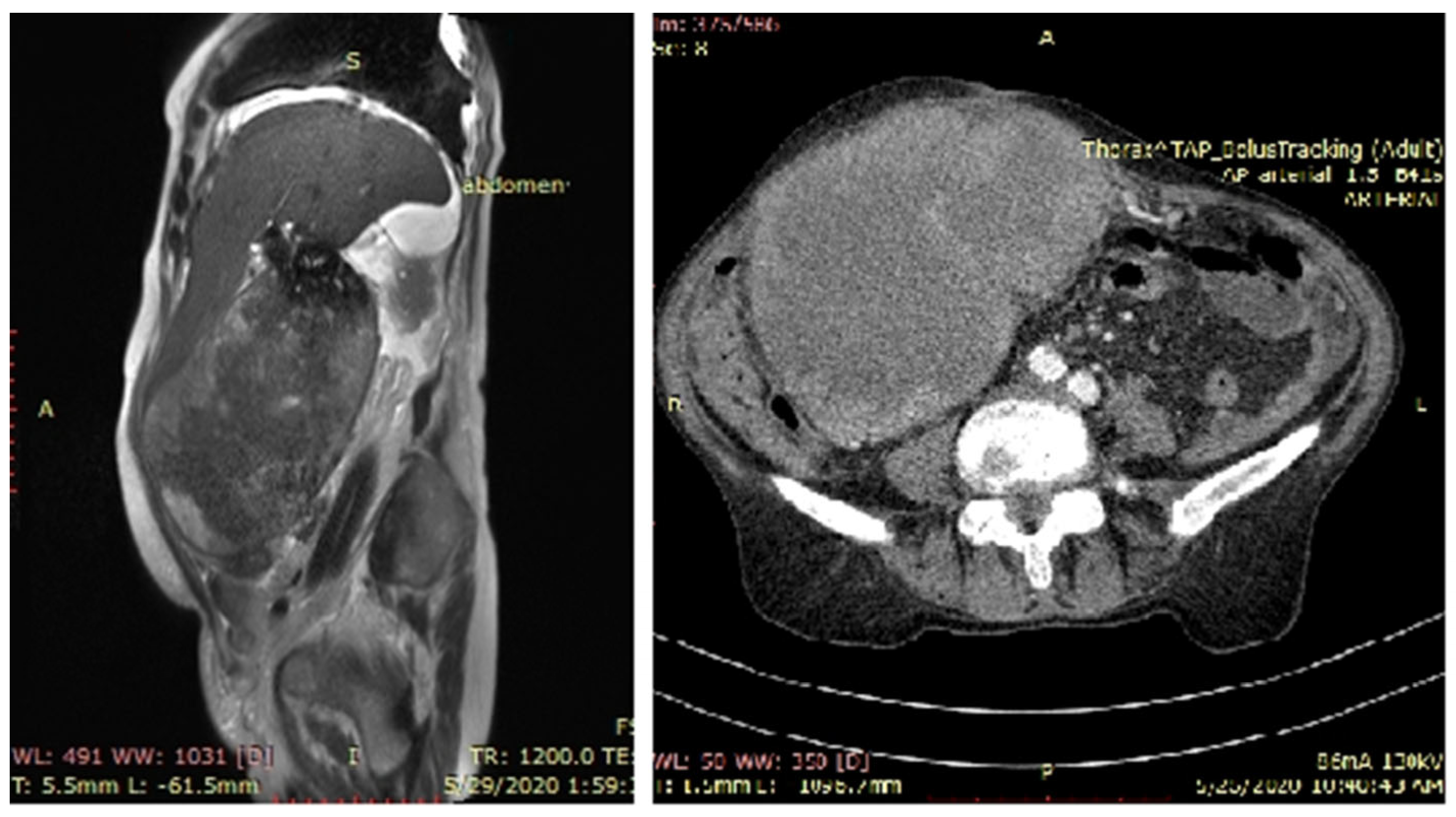 Diagnostics 13 00194 g001