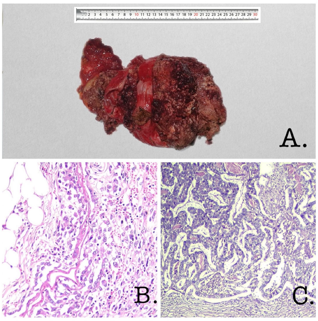 Diagnostics 13 00194 g003
