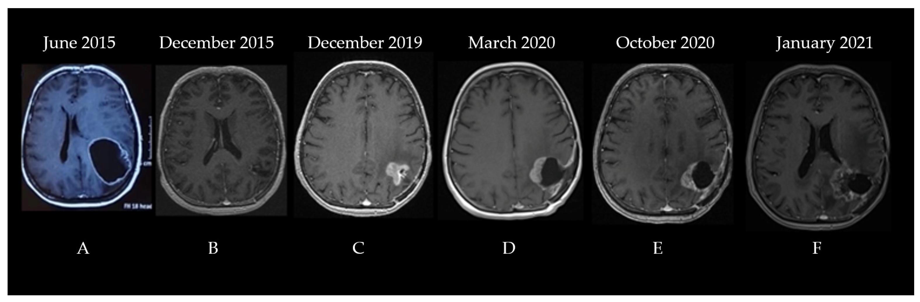Diagnostics 13 00197 g003