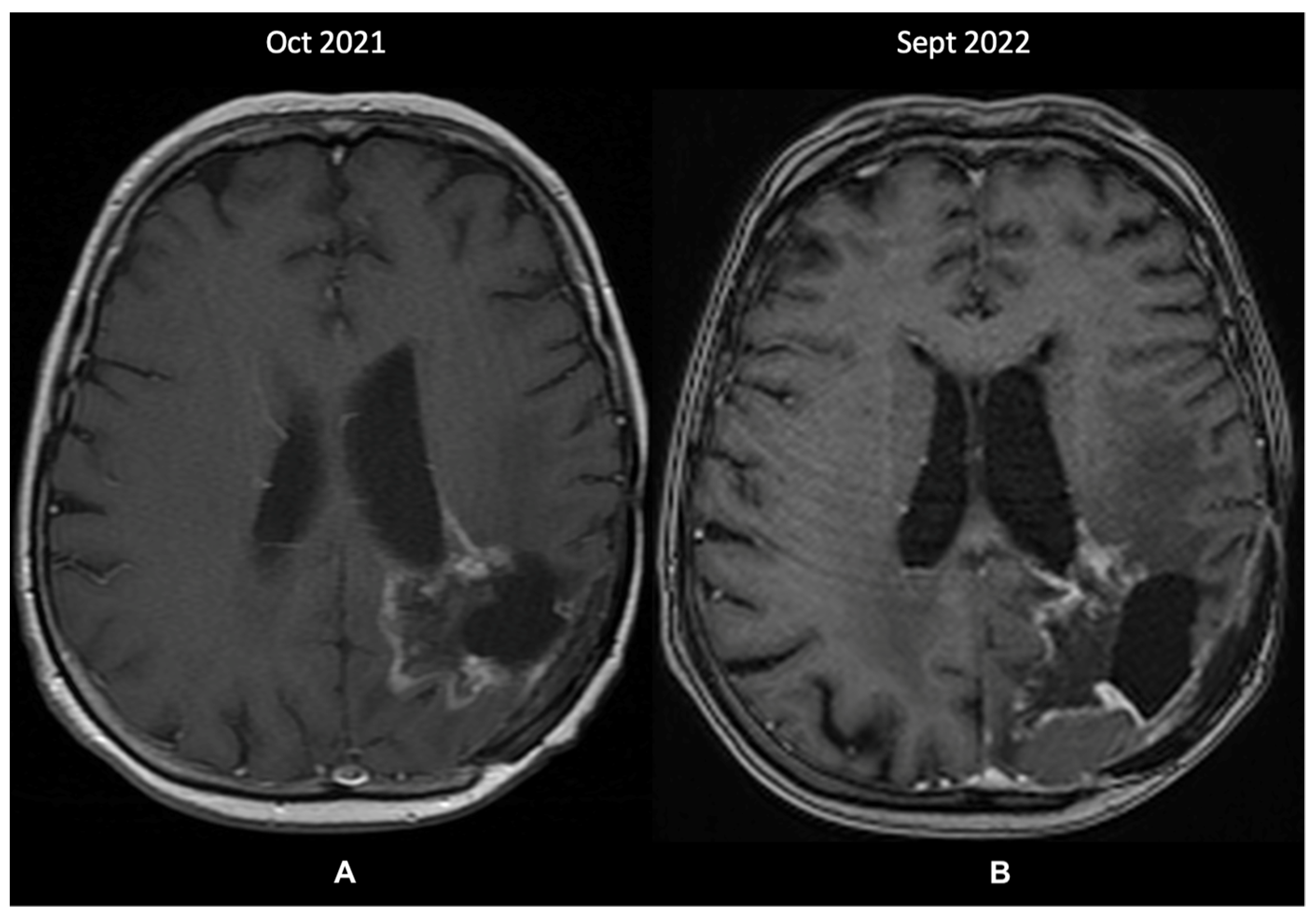 Diagnostics 13 00197 g004