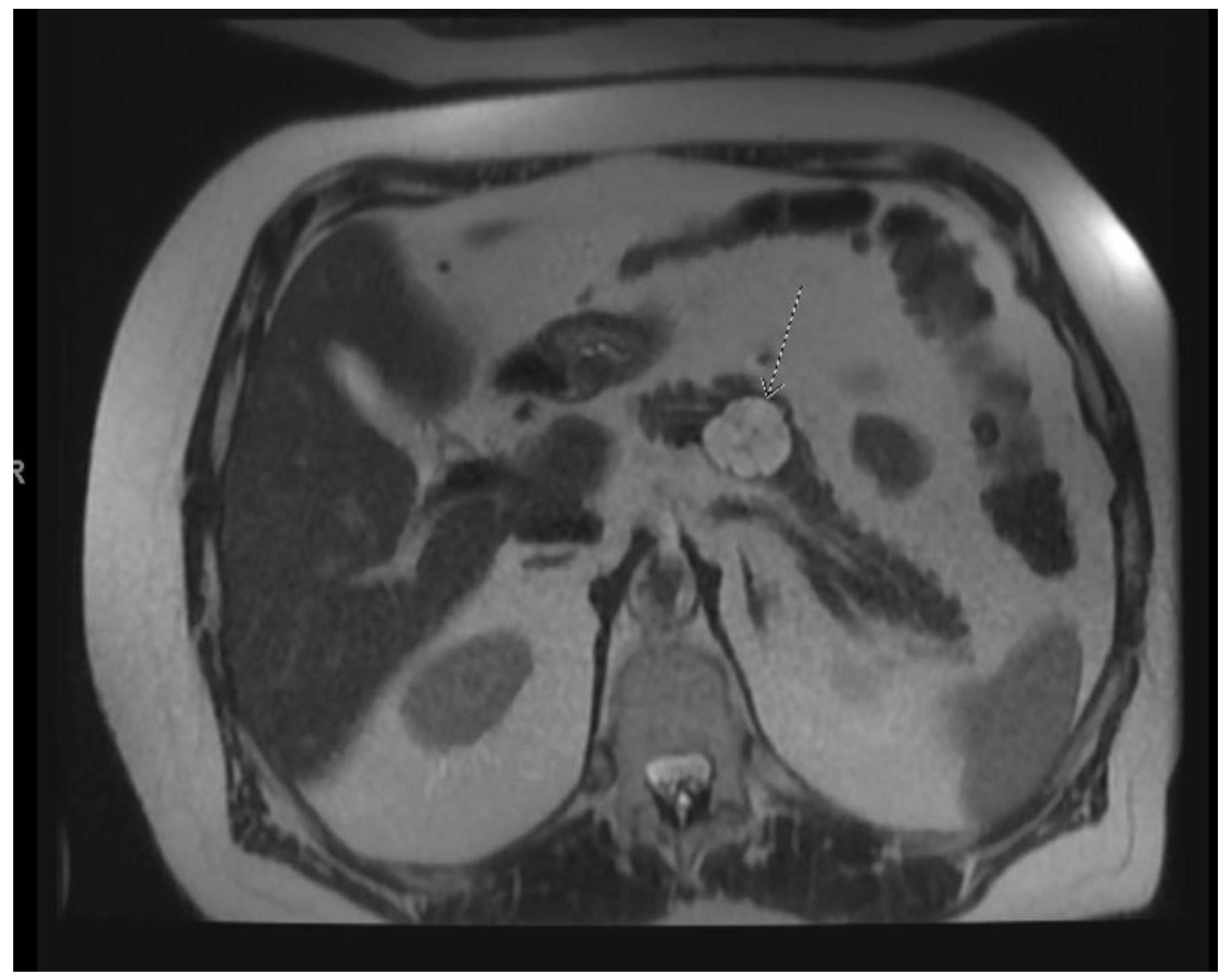 Diagnostics 13 00207 g005