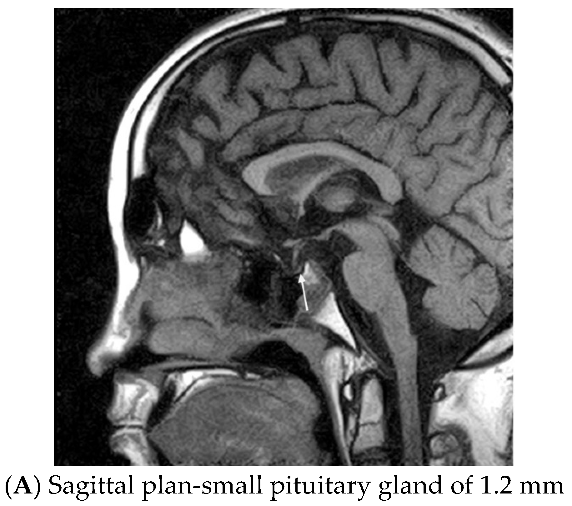 Diagnostics 13 00212 g002a