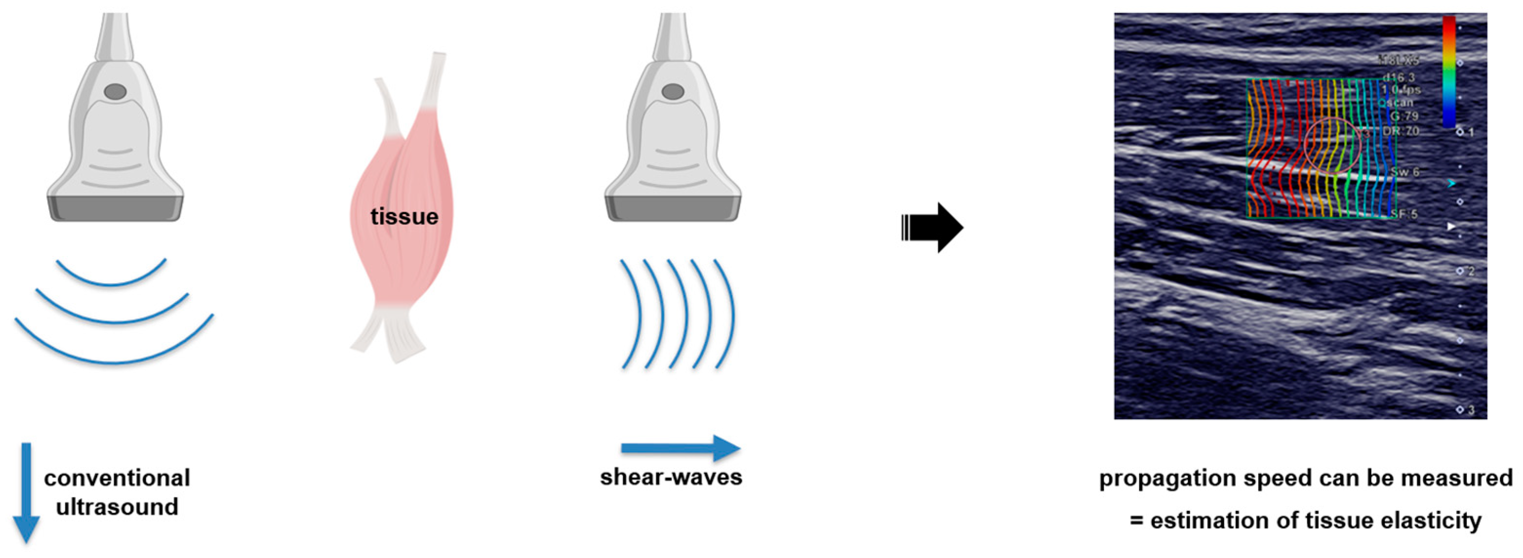 Diagnostics 13 00213 g001