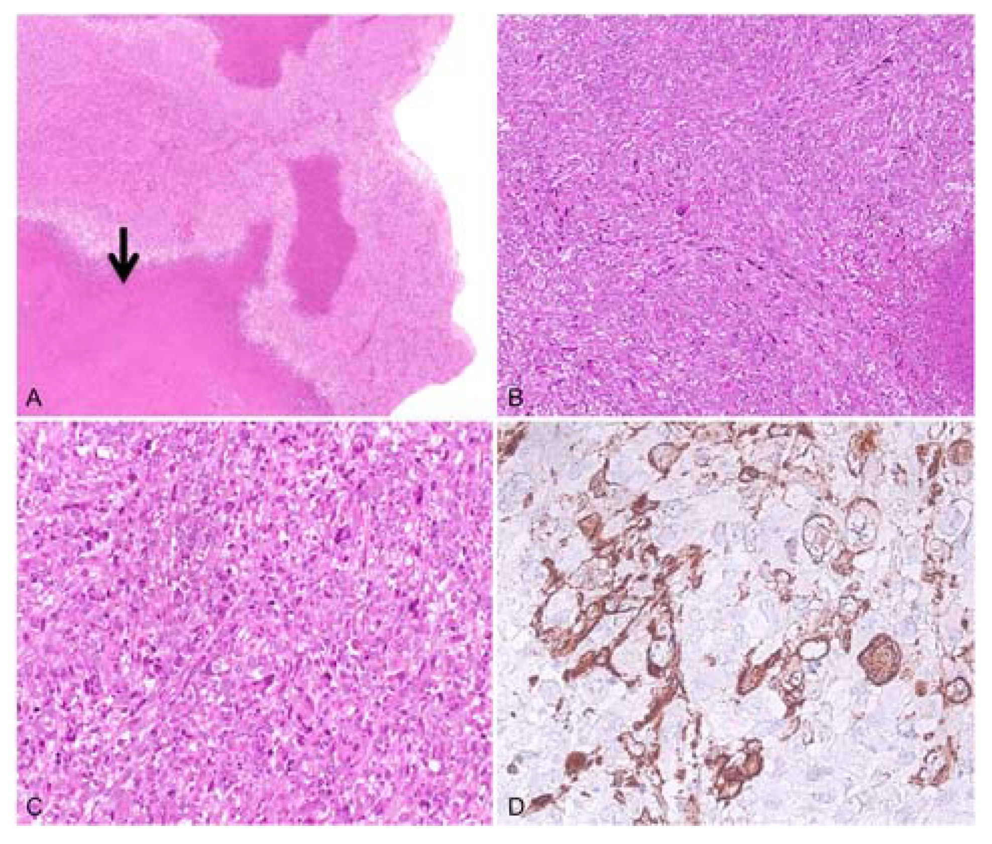 Diagnostics 13 00214 g002 Diagnostics 13 00214 g002