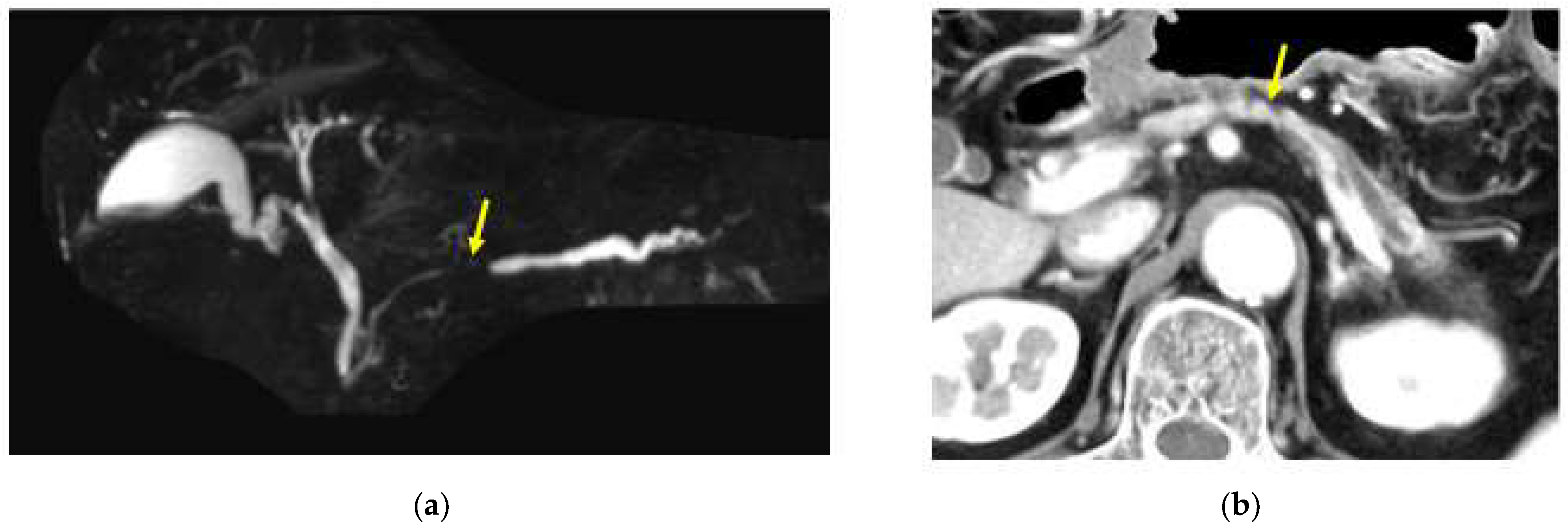 Diagnostics 13 00215 g003 Diagnostics 13 00215 g003