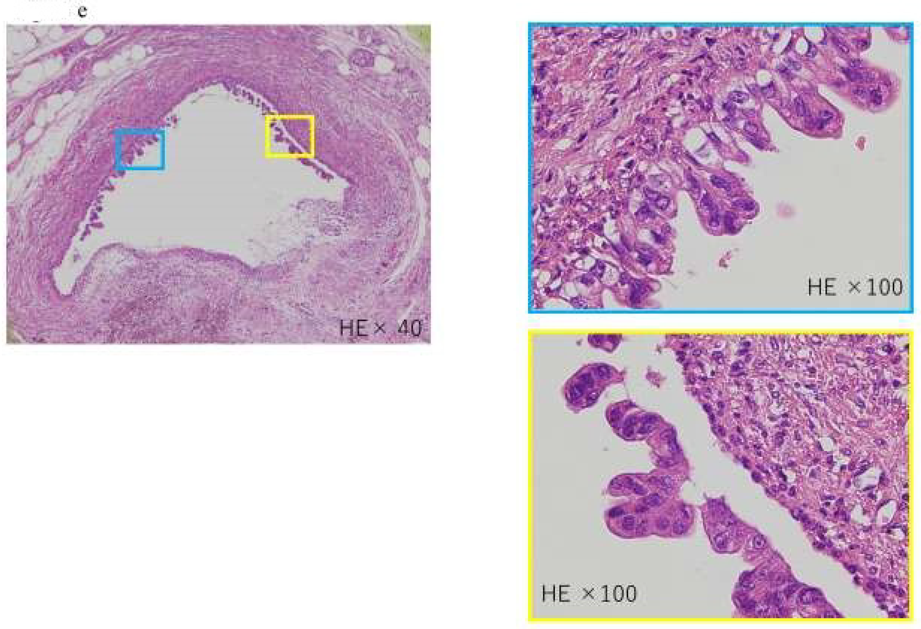 Diagnostics 13 00215 g004b Diagnostics 13 00215 g004b