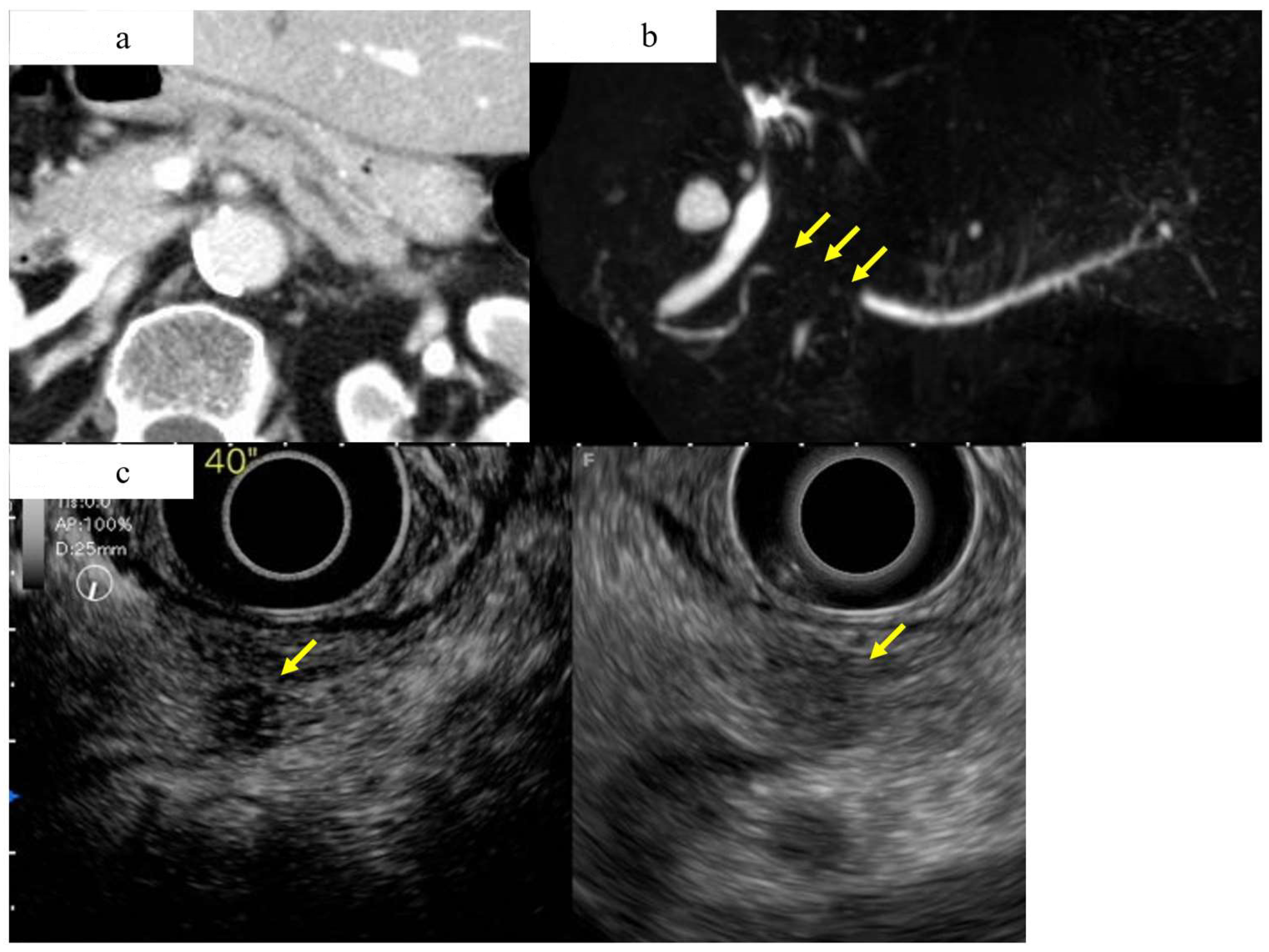 Diagnostics 13 00215 g005 Diagnostics 13 00215 g005