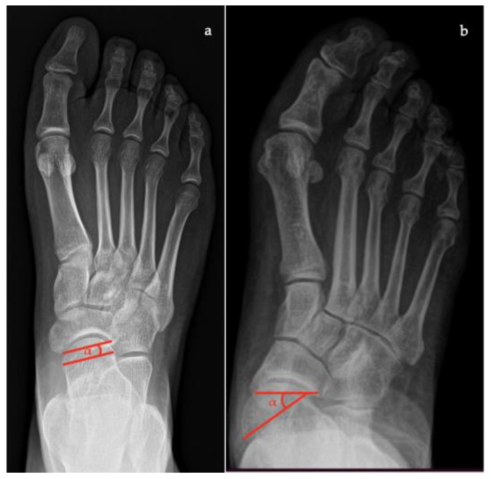 Diagnostics 13 00225 g002