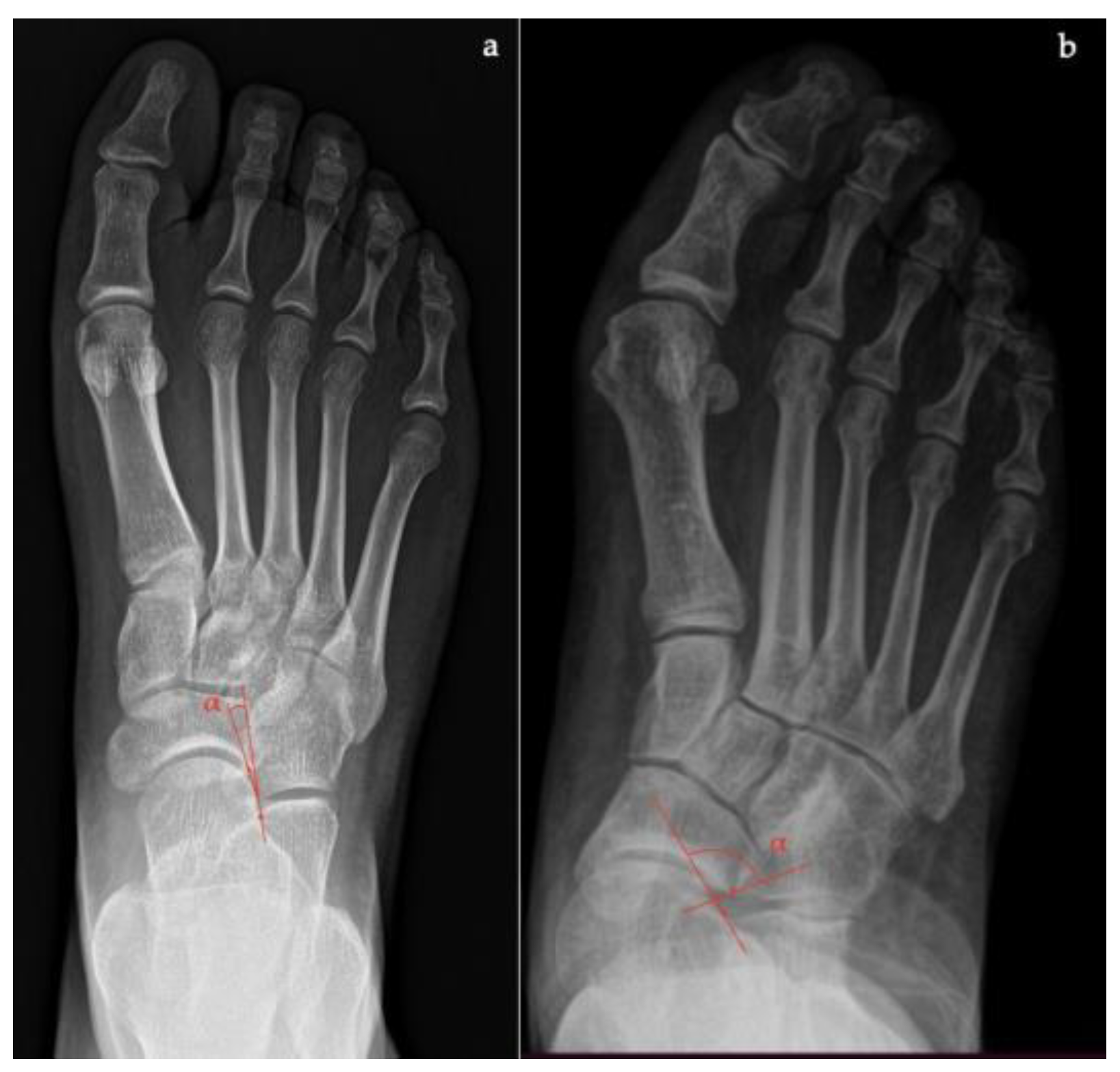 Diagnostics 13 00225 g004