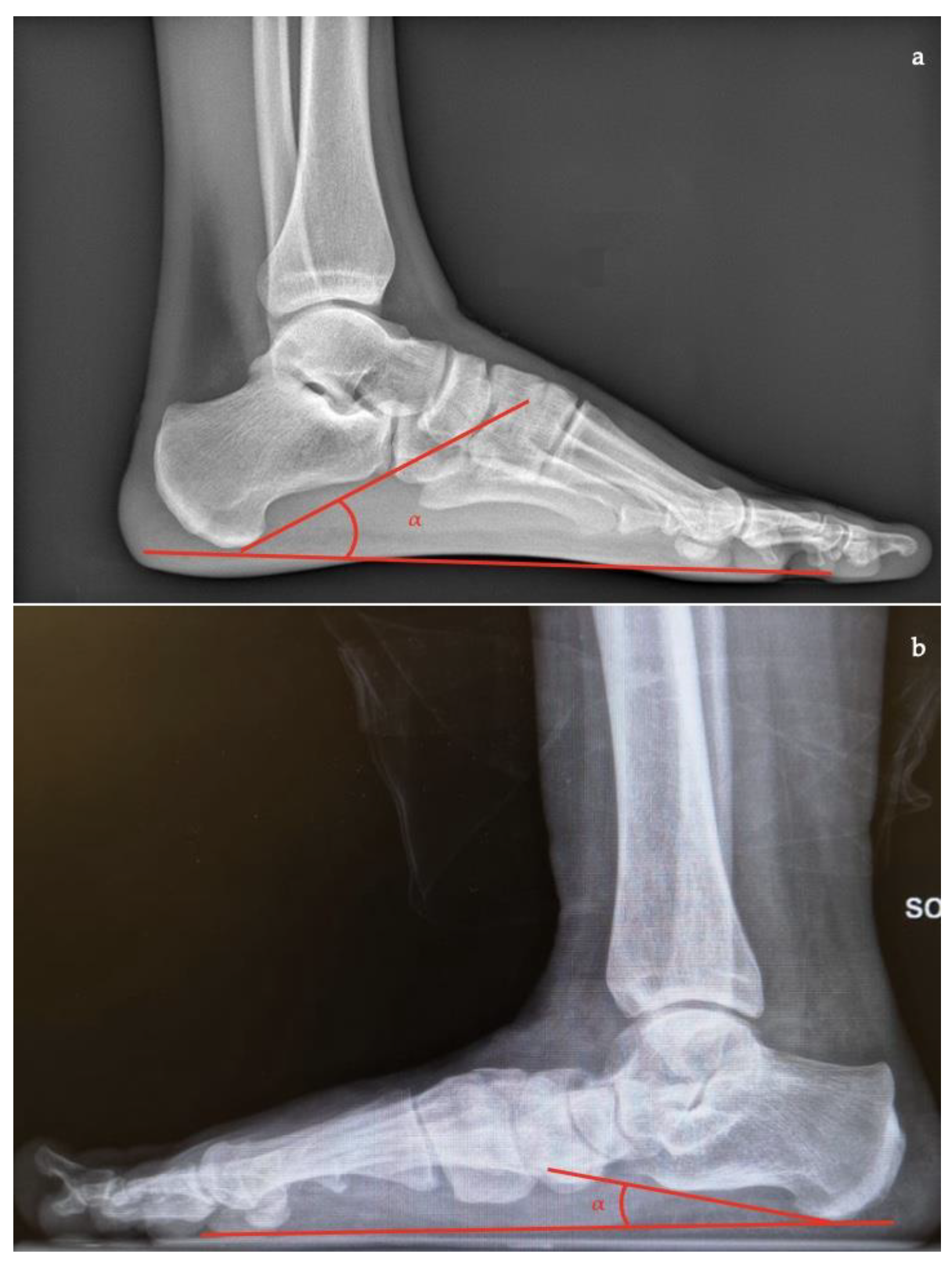 Diagnostics 13 00225 g006