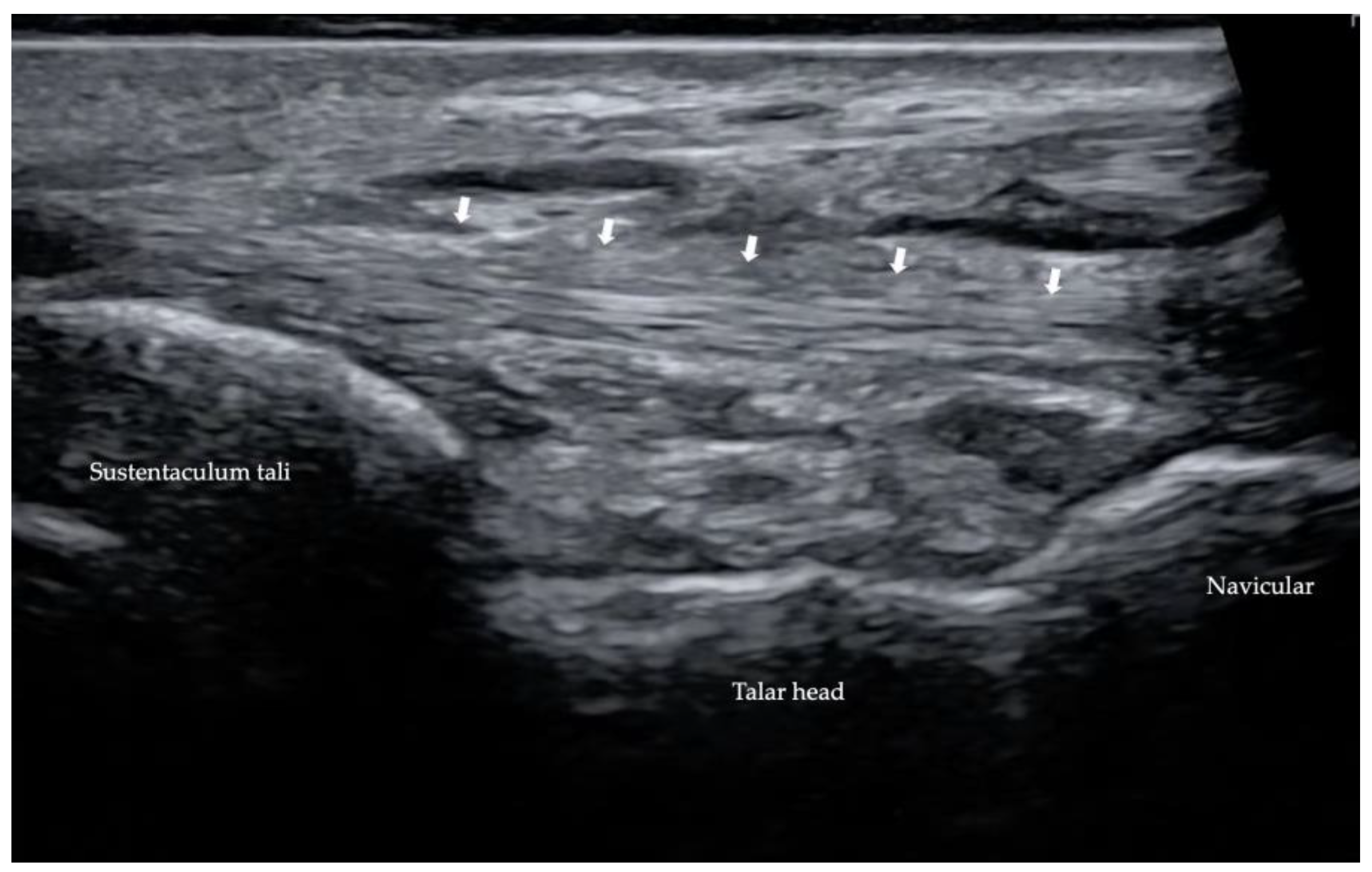 Diagnostics 13 00225 g011