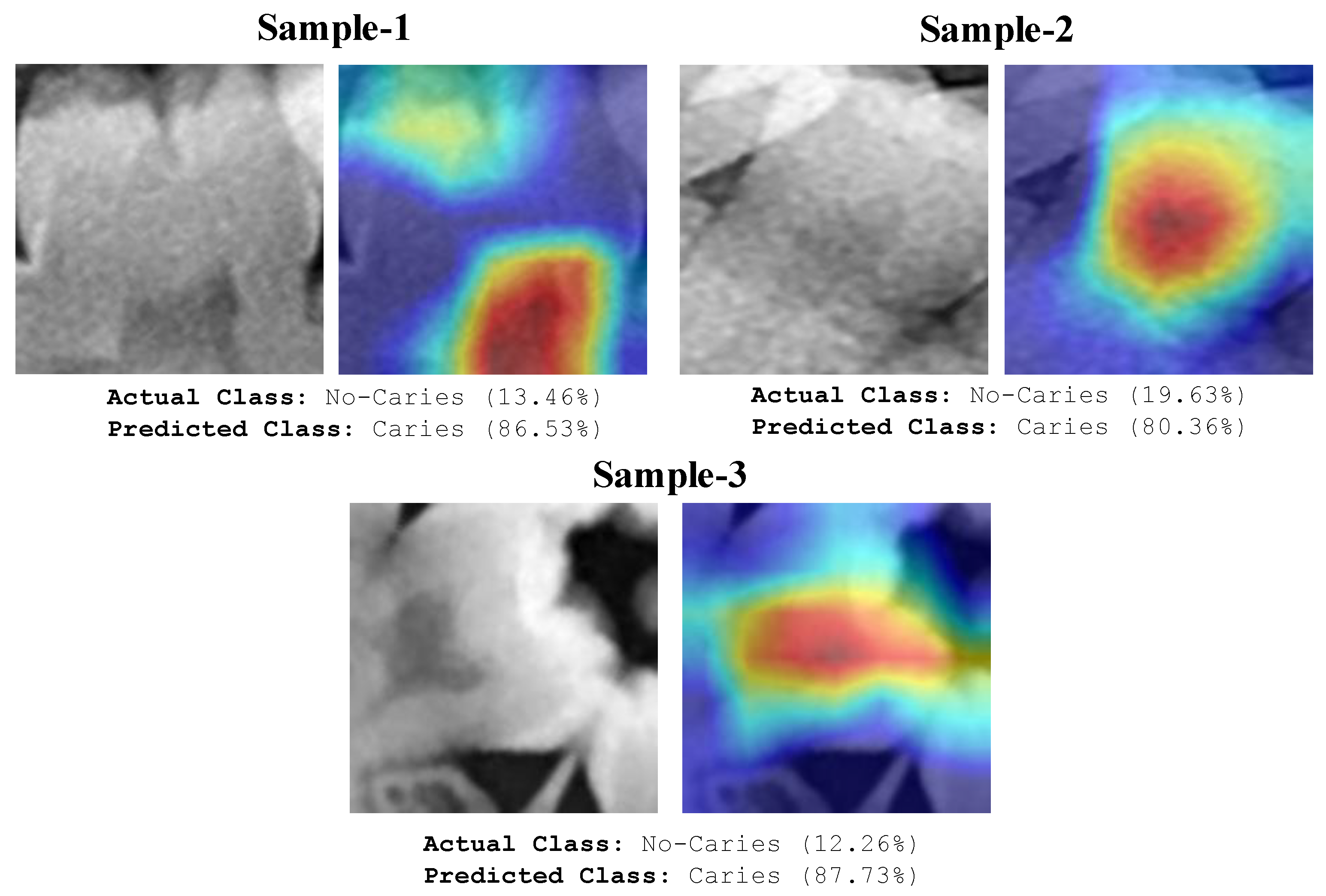 Diagnostics 13 00226 g010 Diagnostics 13 00226 g010