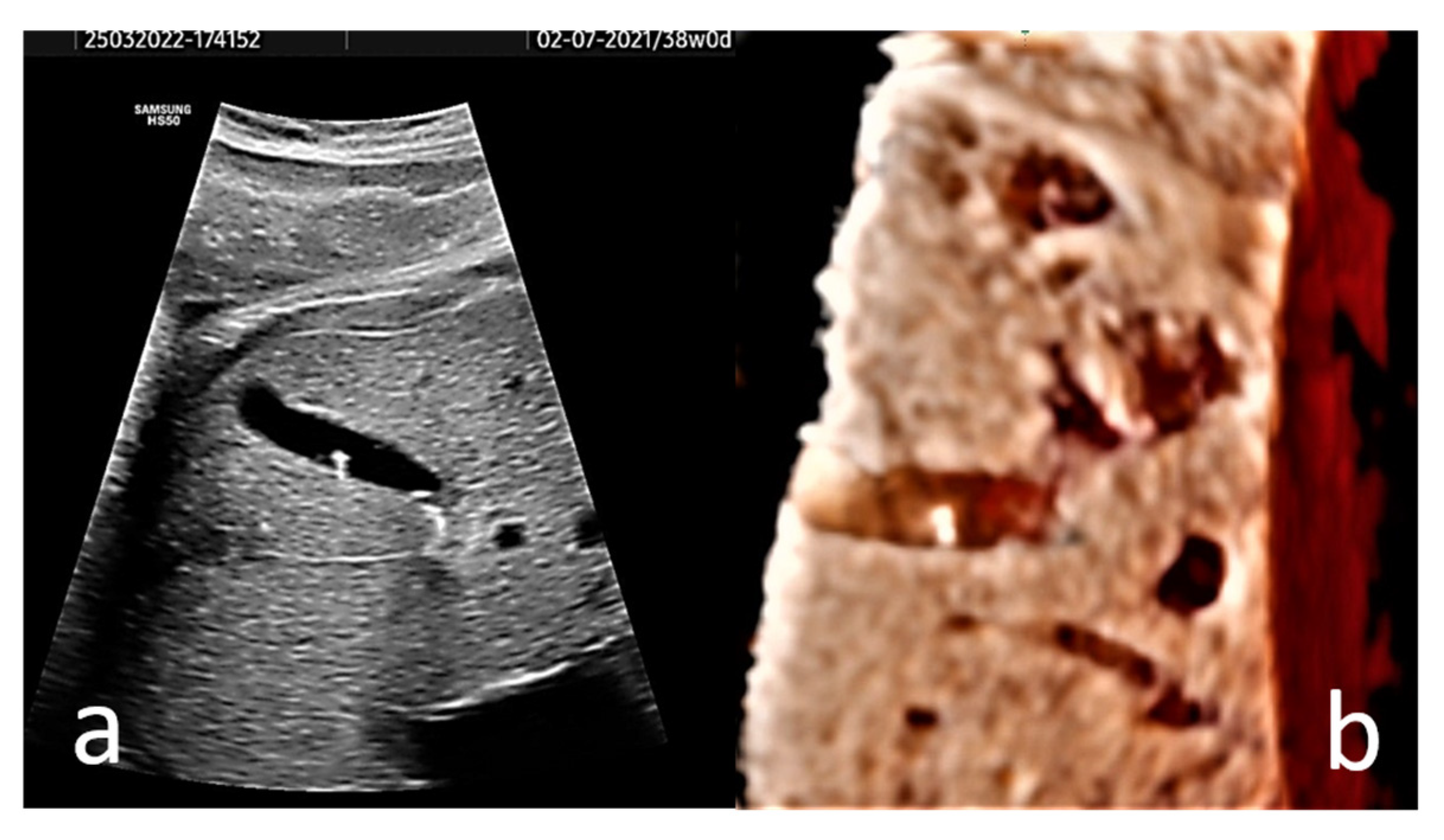 Diagnostics 13 00230 g002