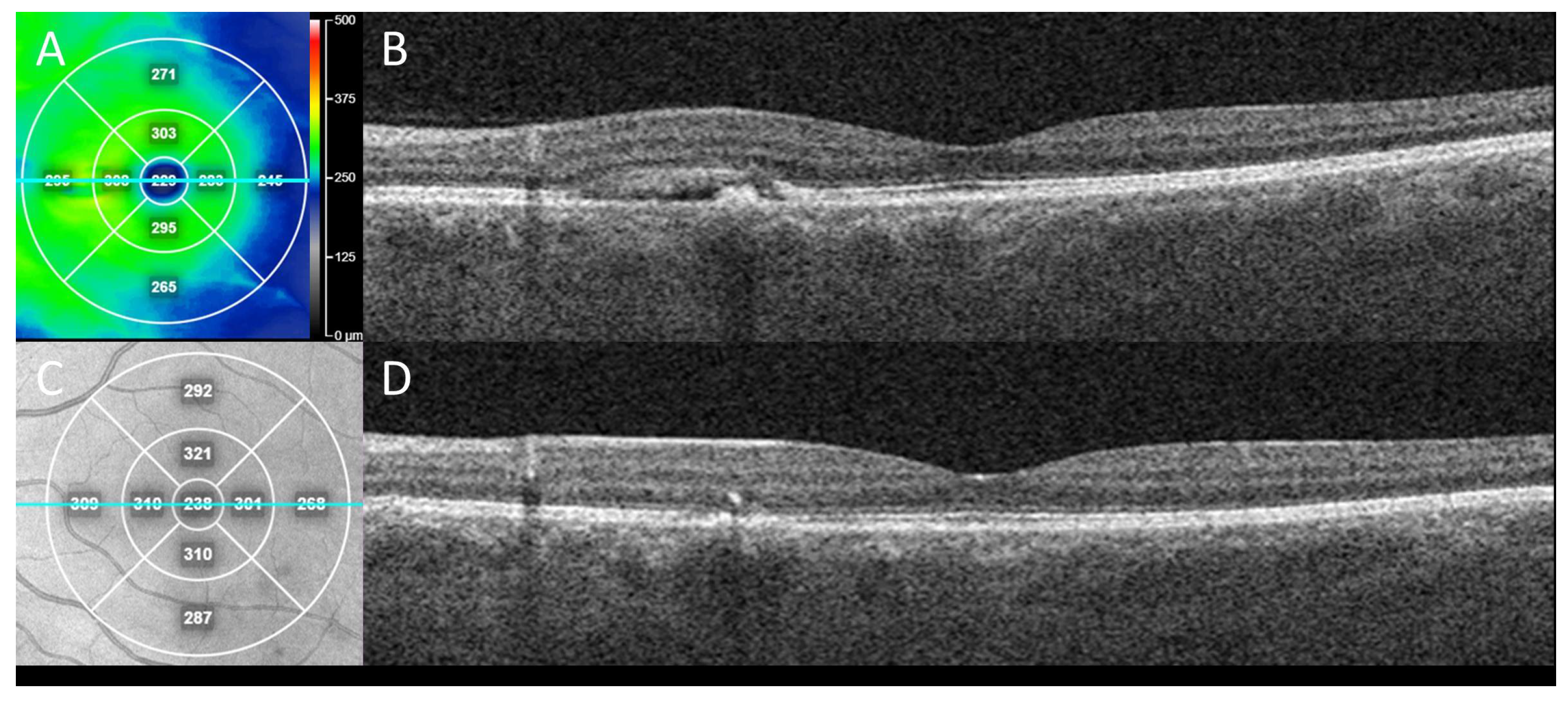 Diagnostics 13 00232 g002 Diagnostics 13 00232 g002