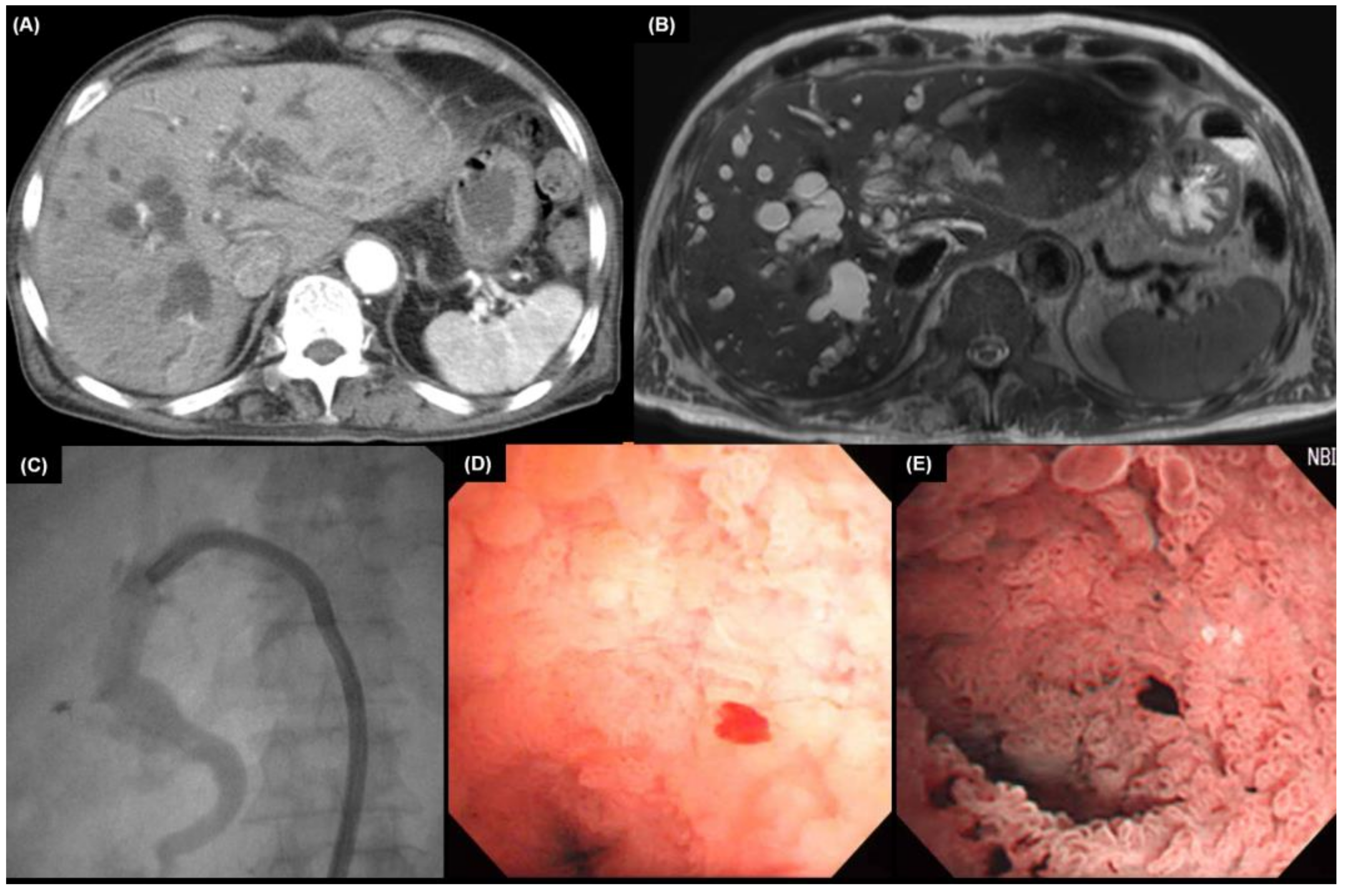 Diagnostics 13 00233 g003