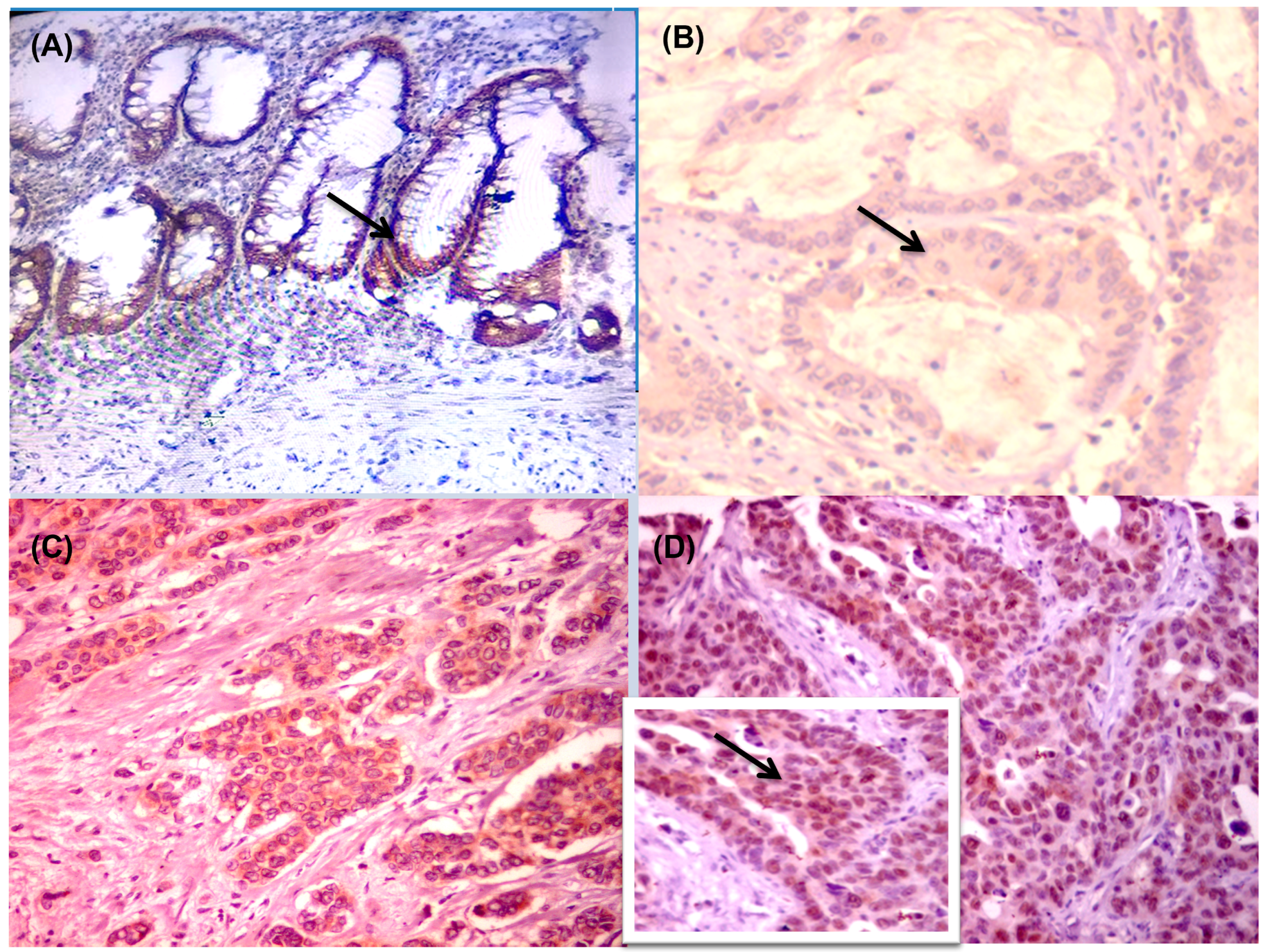 Diagnostics 13 00237 g002 Diagnostics 13 00237 g002
