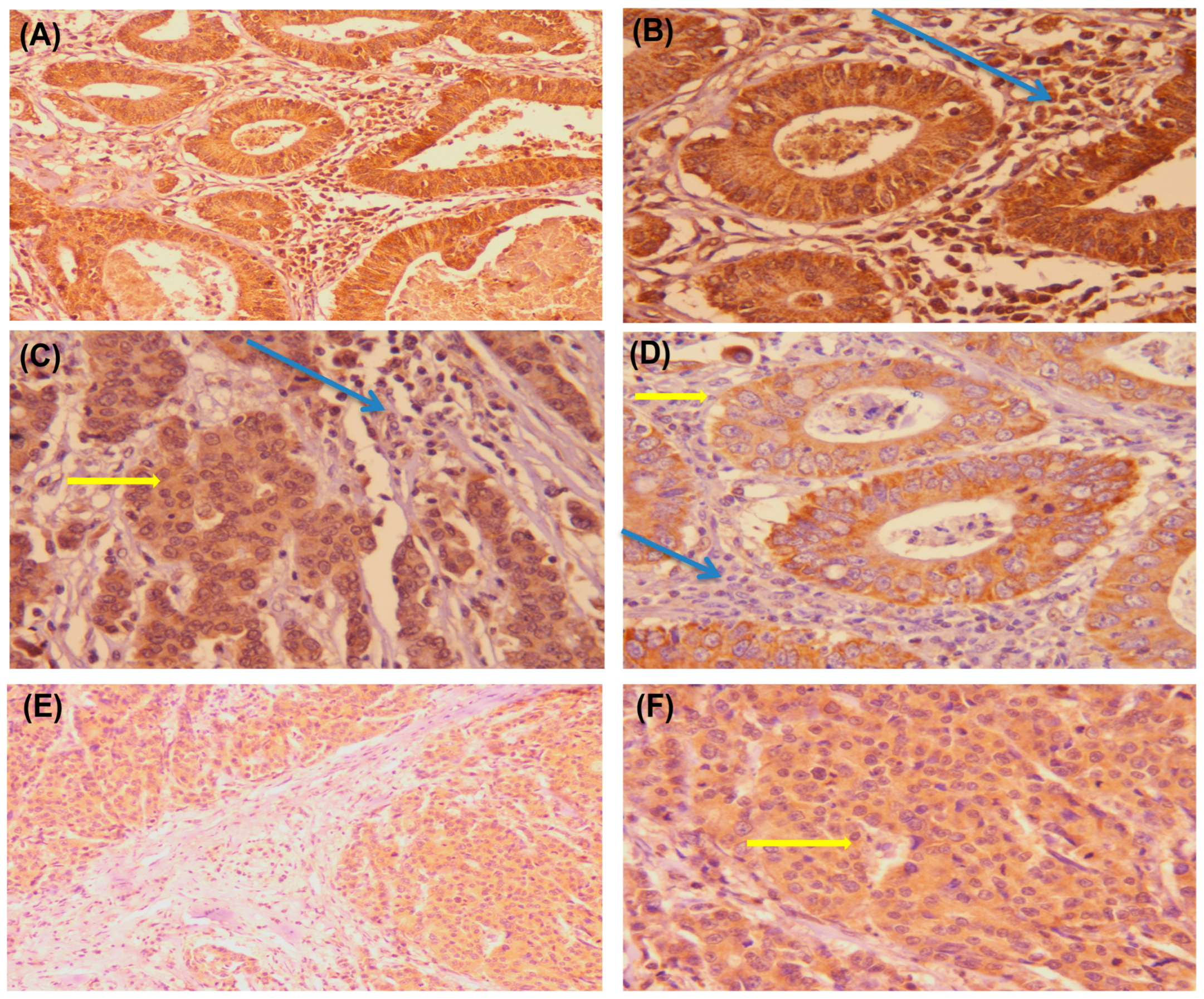 Diagnostics 13 00237 g004 Diagnostics 13 00237 g004