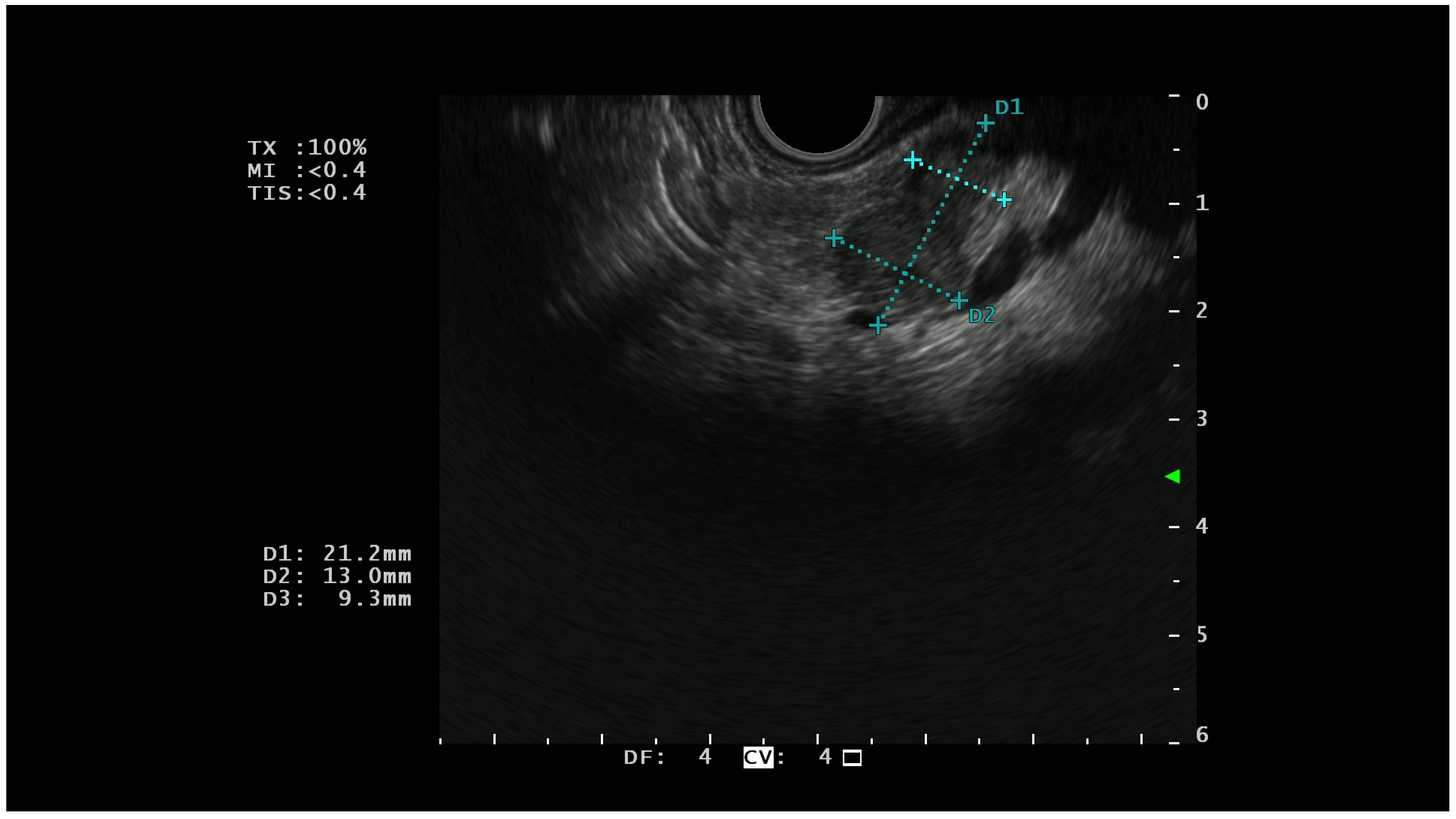 Diagnostics 13 00239 g001 Diagnostics 13 00239 g001