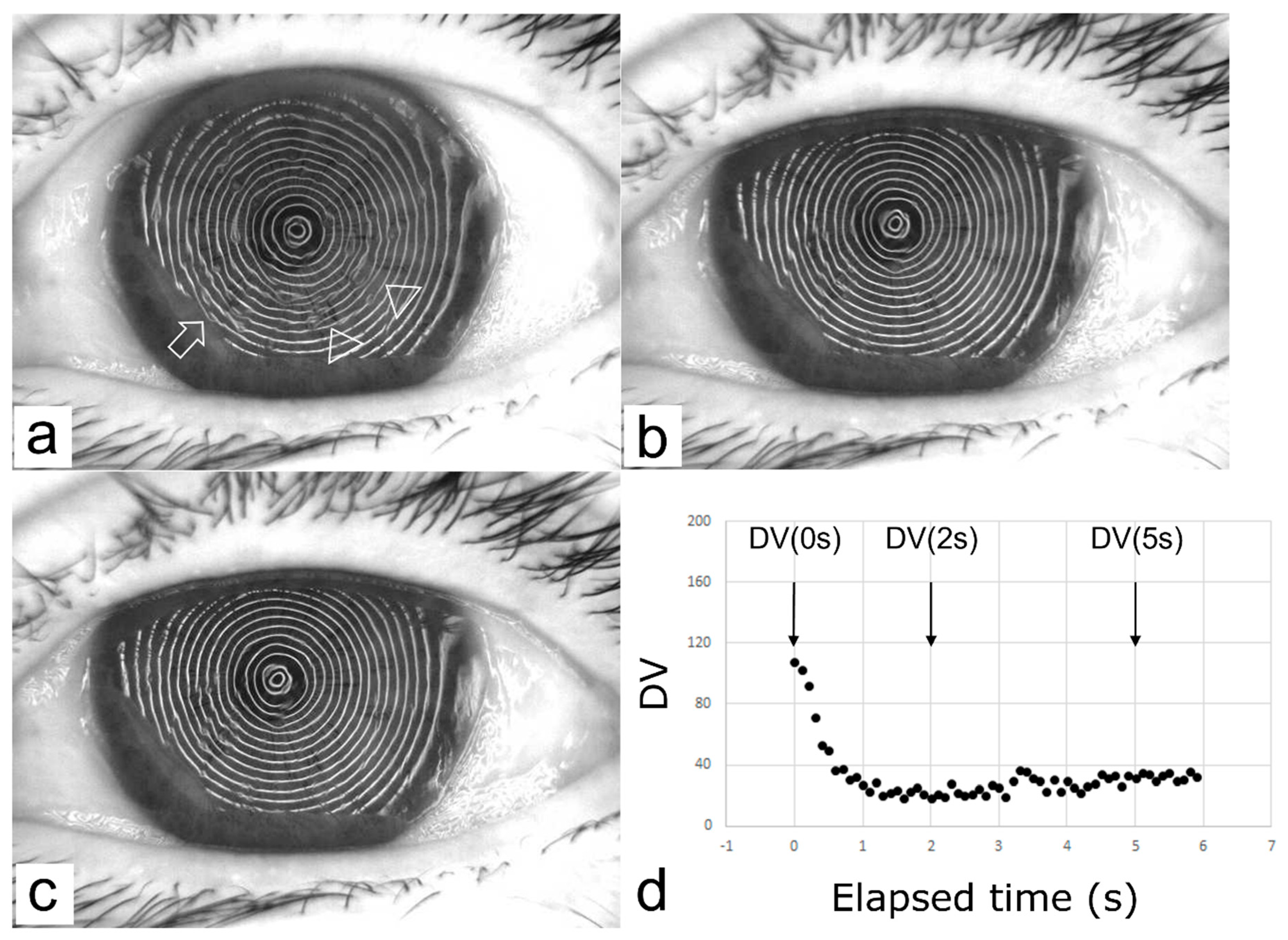 Diagnostics 13 00240 g004