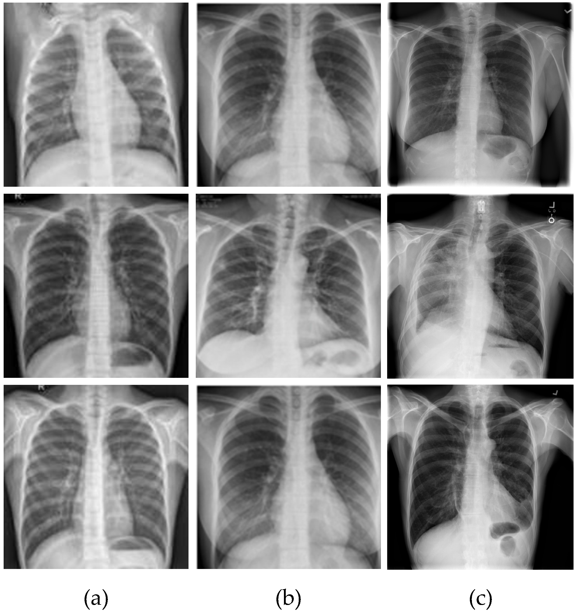 Diagnostics 13 00260 g001